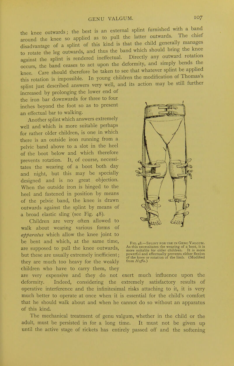 the knee outwards; the best is an external splint furnished with a band around the knee so applied as to pull the latter outwards. The chief disadvantage of a splint of this kind is that the child generally manages to rotate the leg outwards, and thus the band which should bring the knee against the splint is rendered ineffectual. Directly any outward rotation oLurs the band ceases to act upon the deformity, and simply bends the knee ’ Care should therefore be taken to see that whatever splint be applied this rotation is impossible. In young children the modification of Thomas’s splint just described answers very well, and its action may be still further increased by prolonging the low'er end of the iron bar downwards for three to four inches beyond the foot so as to present an effectual bar to walking. Another splint which answers extremely well and which is more suitable perhaps for rather older children, is one in which there is an outside iron running from a pelvic band above to a slot in the heel of the boot below and which therefore prevents rotation. It, of course, necessi- tates the wearing of a boot both day and night, but this may be specially designed and is no great objection. When the outside iron is hinged to the heel and fastened in position by means of the pelvic band, the knee is drawn outwards against the splint by means of a broad elastic sling (see Fig. 48). Children are very often allowed to walk about wearing various forms of apparatus which allow the knee joint to be bent and which, at the same time, are supposed to pull the knee outwards, but these are usually extremely inefficient; they are much too heavy for the weakly children who have to carry them, they are very expensive and they do not exert much influence upon the deformity. Indeed, considering the extremely satisfactory results of operative interference and the infinitesimal risks attaching to it, it is very much better to operate at once when it is essential for the child’s comfort that he should walk about and when he cannot do so without an apparatus of this kind. The mechanical treatment of genu valgum, whether in the child or the adult, must be persisted in for a long time. It must not be given up until the active stage of rickets has entirely passed off and the softening Fig. 48.—Splint for use in Genu Valgum. As this necessitates the wearing of a boot, it is more suitable for older children. It is more powerful and effectually prevents either flexion of the knee or rotation of the limb. (Modified from Hoffa.)