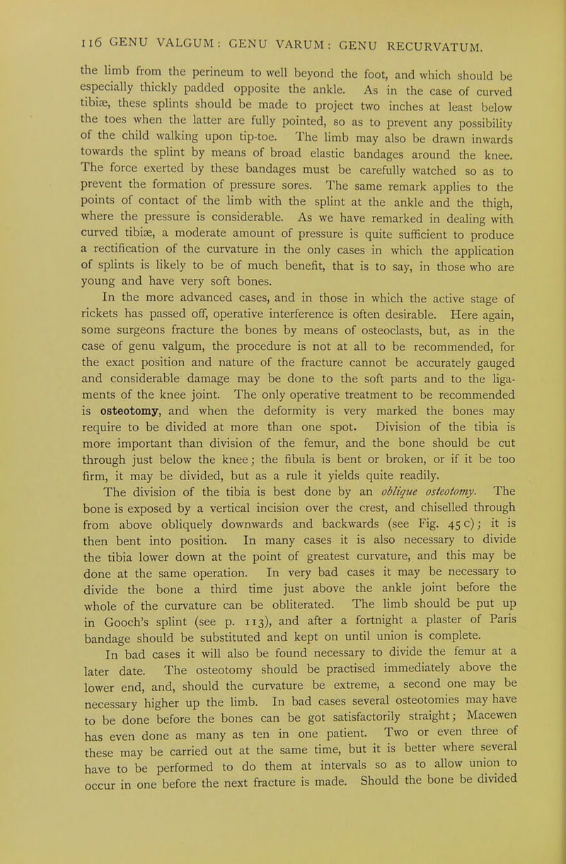 the limb from the perineum to well beyond the foot, and which should be especially thickly padded opposite the ankle. As in the case of curved tibiae, these splints should be made to project two inches at least below the toes when the latter are fully pointed, so as to prevent any possibility of the child walking upon tip-toe. The limb may also be drawn inwards towards the splint by means of broad elastic bandages around the knee. The force exerted by these bandages must be carefully watched so as to prevent the formation of pressure sores. The same remark applies to the points of contact of the limb with the splint at the ankle and the thigh, where the pressure is considerable. As we have remarked in dealing with curved tibise, a moderate amount of pressure is quite sufficient to produce a rectification of the curvature in the only cases in which the application of splints is likely to be of much benefit, that is to say, in those who are young and have very soft bones. In the more advanced cases, and in those in which the active stage of rickets has passed off, operative interference is often desirable. Here again, some surgeons fracture the bones by means of osteoclasts, but, as in the case of genu valgum, the procedure is not at all to be recommended, for the exact position and nature of the fracture cannot be accurately gauged and considerable damage may be done to the soft parts and to the liga- ments of the knee joint. The only operative treatment to be recommended is osteotomy, and when the deformity is very marked the bones may require to be divided at more than one spot. Division of the tibia is more important than division of the femur, and the bone should be cut through just below the knee; the fibula is bent or broken, or if it be too firm, it may be divided, but as a rule it yields quite readily. The division of the tibia is best done by an oblique osteotomy. The bone is exposed by a vertical incision over the crest, and chiselled through from above obliquely downwards and backwards (see Fig. 45 c); it is then bent into position. In many cases it is also necessary to divide the tibia lower down at the point of greatest curvature, and this may be done at the same operation. In very bad cases it may be necessary to divide the bone a third time just above the ankle joint before the whole of the curvature can be obliterated. The limb should be put up in Gooch’s splint (see p. 113), and after a fortnight a plaster of Paris bandage should be substituted and kept on until union is complete. In bad cases it will also be found necessary to divide the femur at a later date. The osteotomy should be practised immediately above the lower end, and, should the curvature be extreme, a second one may be necessary higher up the limb. In bad cases several osteotomies may have to be done before the bones can be got satisfactorily straight; Macewen has even done as many as ten in one patient. Two or even three of these may be carried out at the same time, but it is better where several have to be performed to do them at intervals so as to allow union to occur in one before the next fracture is made. Should the bone be divided