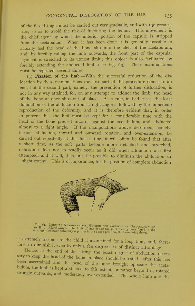 of the flexed thigh must be carried out very gradually, and with tl;e greatest care, so as to avoid the risk of fracturing the femur. This movement is the chief agent by which the anterior portion of the capsule is stripped from the acetabulum. When it has been done it is generally possible to actually feel the head of the bone slip into the cleft of the acetabulum, and, by forcibly rolling the limb outwards, the front part of the capsular ligament is stretched to its utmost limit; this object is also facilitated by forcibly extending the abducted limb (see Fig. 63). These manipulations must be repeated several times. (3) Fixation of the limb.—With the successful reduction of the dis- location by these manipulations the first part of the procedure comes to an end, but the second part, namely, the prevention of further dislocation, is not in any way attained, for, on any attempt to adduct the limb, the head of the bone at once slips out of place. As a rule, in bad cases, the least diminution of the abduction from a right angle is followed by the immediate reproduction of the deformity, and it is therefore evident that, in order to prevent this, the limb must be kept for a considerable time with the head of the bone pressed inwards against the acetabulum, and abducted almost to a right angle. If the manipulations above described, namely, flexion, abduction, inward and outward rotation, and over-extension, be carried out repeatedly at this first sitting, it will often be found that after a short time, as the soft parts become more detached and stretched, re-luxation does not so readily occur as it did when adduction was first attempted, and it will, therefore, be possible to diminish the abduction to a slight extent. This is of importance, for the position of complete abduction IS extremely irksome to the child if maintained for a lone time. and. therP-
