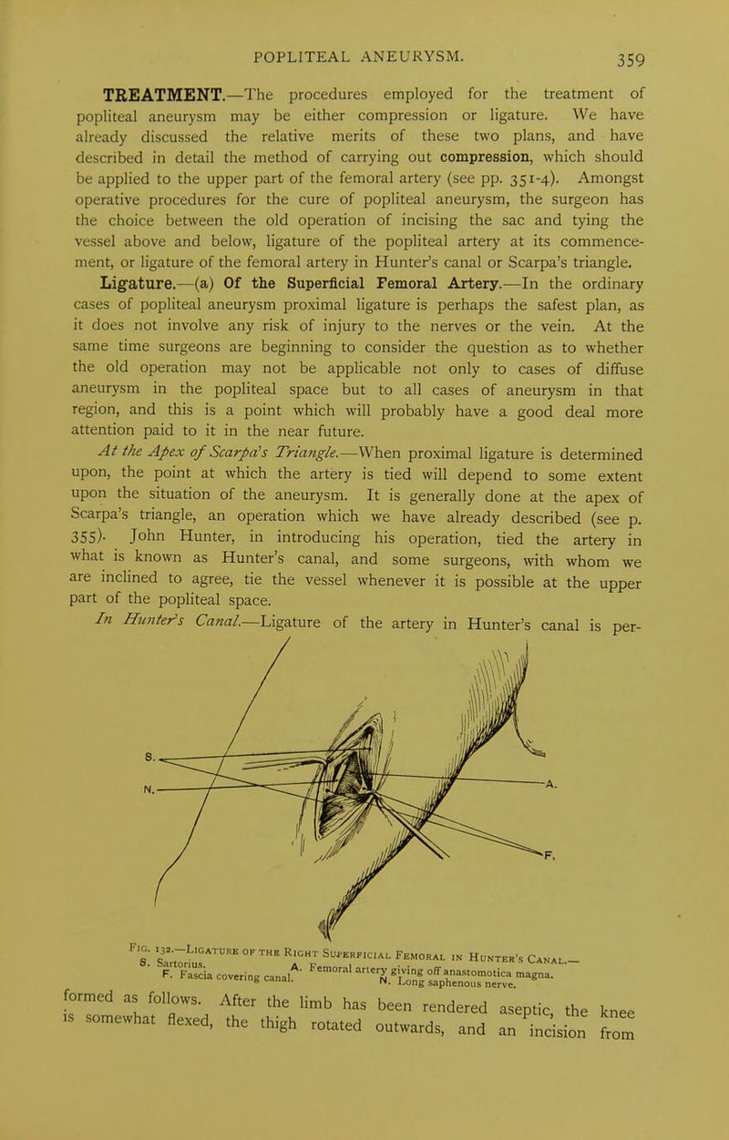 TREATMENT. —The procedures employed for the treatment of popliteal aneurysm may be either compression or ligature. We have already discussed the relative merits of these two plans, and have described in detail the method of carrying out compression, which should be applied to the upper part of the femoral artery (see pp. 351-4). Amongst operative procedures for the cure of popliteal aneurysm, the surgeon has the choice between the old operation of incising the sac and tying the vessel above and below, ligature of the popliteal artery at its commence- ment, or ligature of the femoral artery in Hunter’s canal or Scarpa’s triangle. Ligature.—(a) Of the Superficial Femoral Artery.—In the ordinary cases of popliteal aneurysm proximal ligature is perhaps the safest plan, as it does not involve any risk of injury to the nerves or the vein. At the same time surgeons are beginning to consider the question as to whether the old operation may not be applicable not only to cases of diffuse aneurysm in the popliteal space but to all cases of aneurysm in that region, and this is a point which will probably have a good deal more attention paid to it in the near future. At the Apex of Scarpa's Tria?igk.—When proximal ligature is determined upon, the point at which the artery is tied will depend to some extent upon the situation of the aneurysm. It is generally done at the apex of Scarpa’s triangle, an operation which we have already described (see p. 355)- John Hunter, in introducing his operation, tied the artery in what is known as Hunter’s canal, and some surgeons, with whom we are inclined to agree, tie the vessel whenever it is possible at the upper part of the popliteal space. I71 Htmter^s Canal.—Ligature of the artery in Hunter’s canal is per- is somewhat flexed, the thigh rotated outwards, and an formed IN Hunter’s Canal.— nastomotica magna. ceptic, the knee an incision from F. ■A.