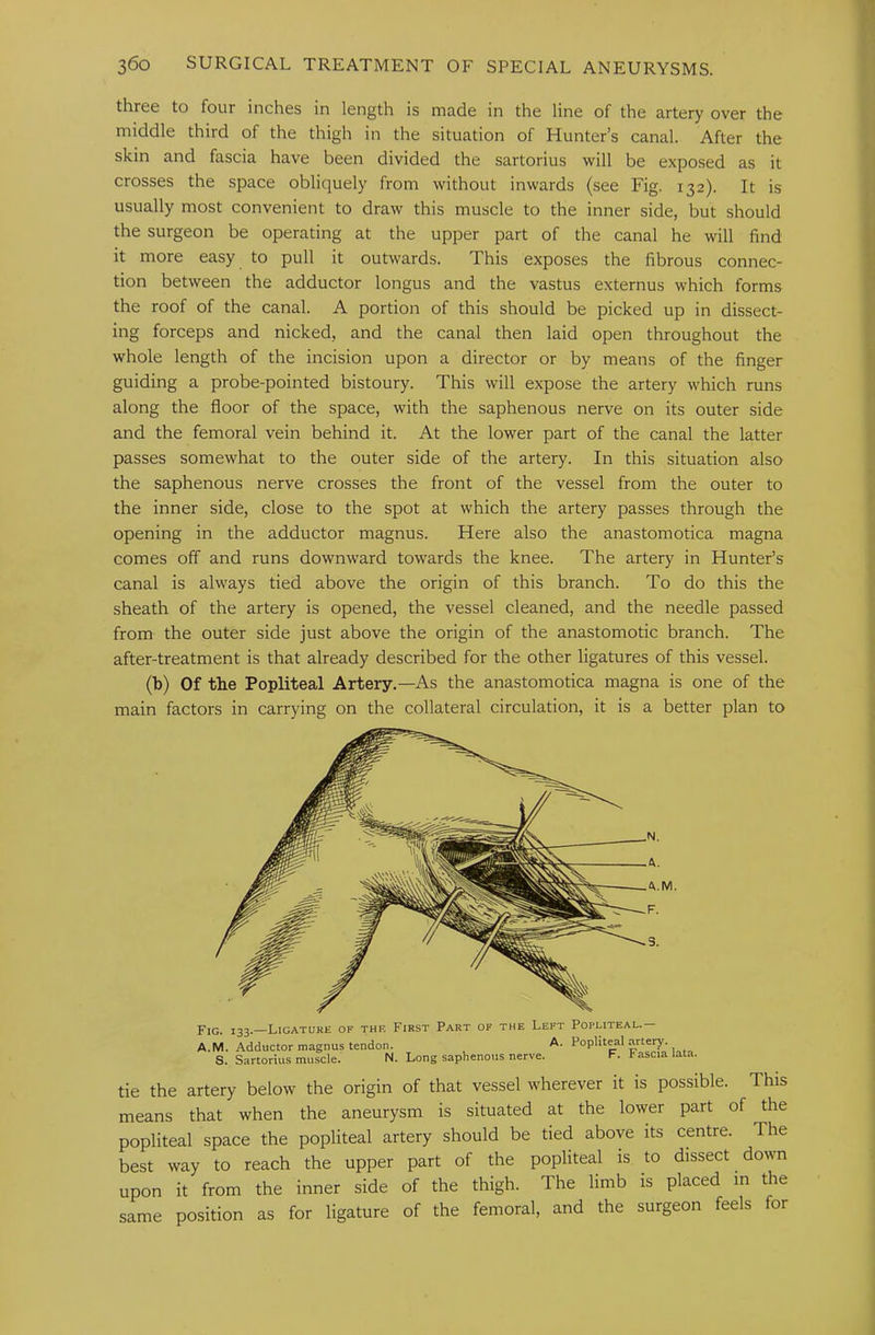 three to four inches in length is made in the line of the artery over the middle third of the thigh in the situation of Hunter’s canal. After the skin and fascia have been divided the sartorius will be exposed as it crosses the space obliquely from without inwards (see Fig. 132). It is usually most convenient to draw this muscle to the inner side, but should the surgeon be operating at the upper part of the canal he will find it more easy to pull it outwards. This exposes the fibrous connec- tion between the adductor longus and the vastus externus which forms the roof of the canal. A portion of this should be picked up in dissect- ing forceps and nicked, and the canal then laid open throughout the whole length of the incision upon a director or by means of the finger guiding a probe-pointed bistoury. This will expose the artery which runs along the floor of the space, with the saphenous nerve on its outer side and the femoral vein behind it. At the lower part of the canal the latter passes somewhat to the outer side of the artery. In this situation also the saphenous nerve crosses the front of the vessel from the outer to the inner side, close to the spot at which the artery passes through the opening in the adductor magnus. Here also the anastomotica magna comes off and runs downward towards the knee. The artery in Hunter’s canal is always tied above the origin of this branch. To do this the sheath of the artery is opened, the vessel cleaned, and the needle passed from the outer side just above the origin of the anastomotic branch. The after-treatment is that already described for the other ligatures of this vessel. (b) Of tbe Popliteal Artery.—As the anastomotica magna is one of the main factors in carrying on the collateral circulation, it is a better plan to Fig. 133.—Ligature of the First Part of the Left Popliteal.— A.M. Adductor magnus tendon. A. Poplit^l artery. S. Sartorius muscle. N. Long saphenous nerve. F. Fascia lata. tie the artery below the origin of that vessel wherever it is possible. This means that when the aneurysm is situated at the lower part of the popliteal space the popliteal artery should be tied above its centre. The best way to reach the upper part of the popliteal is to dissect dovm upon it from the inner side of the thigh. The limb is placed in the same position as for ligature of the femoral, and the surgeon feels for