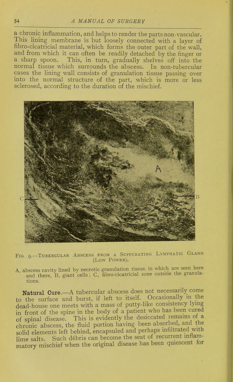 a chronic inflammation, and helps to render the parts non-vascular. This lining membrane is but loosely connected with a layer of fibro-cicatricial material, which forms the outer part of the wall, and from which it can often be readily detached by the finger or a sharp spoon. This, in turn, gradually shelves off into the normal tissue which surrounds the abscess. In non-tubercular cases the lining wall consists of granulation tissue passing over into the normal structure of the part, which is more or less sclerosed, according to the duration of the mischief. Fig. 9.—Tubercular Abscess from a Suppurating Lymphatic Gland (Low Power). A. abscess cavity lined by necrotic granulation tissue, in which are seen here and there, B, giant cells; C. fibro-cicatricial zone outside the granula- tions. Natural Cure.—A tubercular abscess does not necessarily come to the surface and burst, if left to itself. Occasionally m the dead-house one meets with a mass of putty-like consistency lying in front of the spine in the body of a patient who has been cured of spinal disease. This is evidently the desiccated remains of a chronic abscess, the fluid portion having been absorbed, and the solid elements left behind, encapsuled and perhaps infiltrated with lime salts. Such debris can become the seat of recurrent inflam- matory mischief when the original disease has been quiescent tor