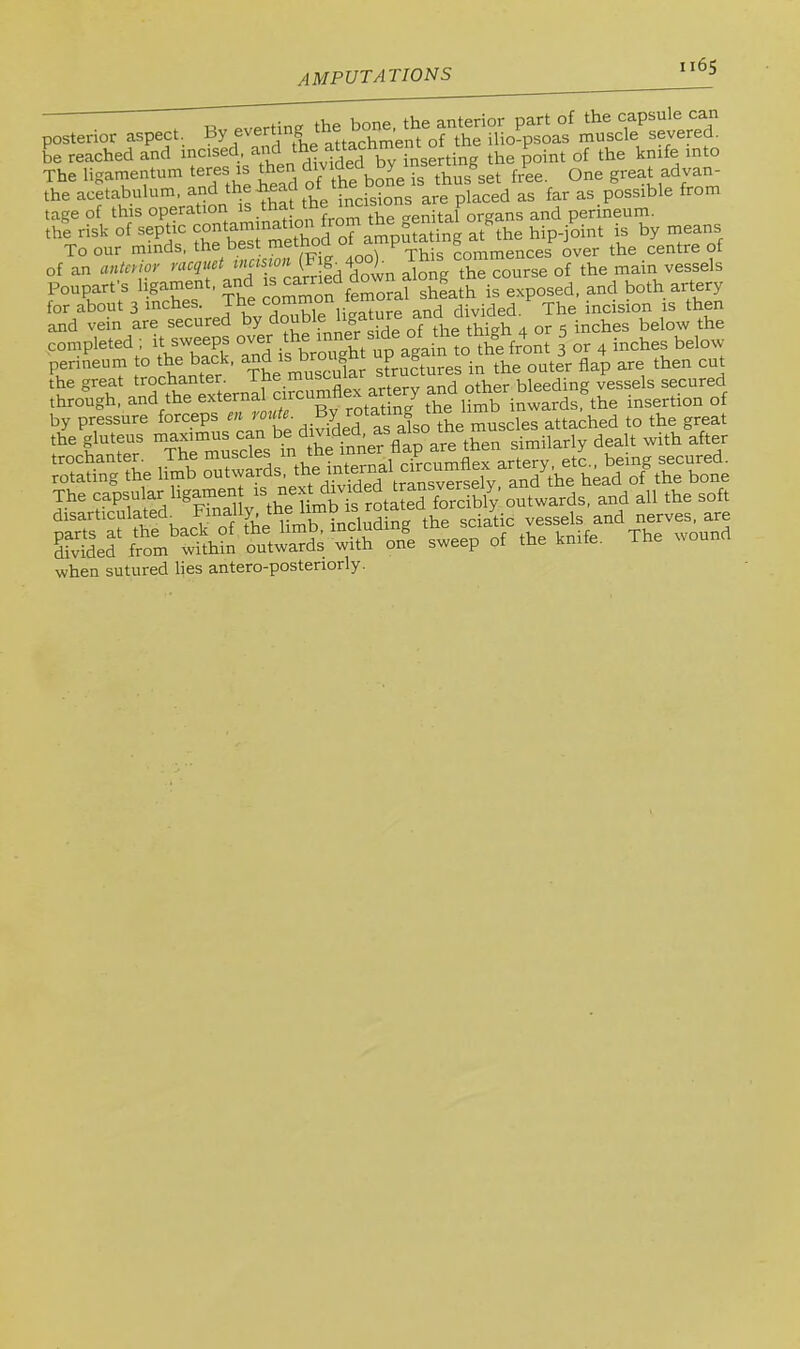 posterior aspec. By .veering be reached and incised, divided by inserting the point of the knife into The ligainentum teres is *en d thus set free. One great advan- the acetabulum, the head placed as far as possible from tage of this operation is.tna crenital organs and perineum, the risk of septic j^od of amputating at the hip-joint is by means To our minds, the best metimu rnmmences over the centre of of an anta ior (Fig^^^ Th^ main vessels Poupart's ligament, and is earriea gUeath is exposed, and both artery for about 3 inches. The ^^jf^^ure an^^^ The incision is then and vein are secured y :-„er side of the thigh 4 or 5 inches below the completed ; it sweeps over the '^iner ^ ^ inches below perineum to the back, “d is bro ght ^g ^^p then cut the great trochanter. The muse , ^ bleeding vessels secured throtf h, and the the S in«arfs®the insertion of by pressure forceps en loute. g muscles attached to the great ti^teus n.ari„rus c» when sutured lies antero-posteriorly.