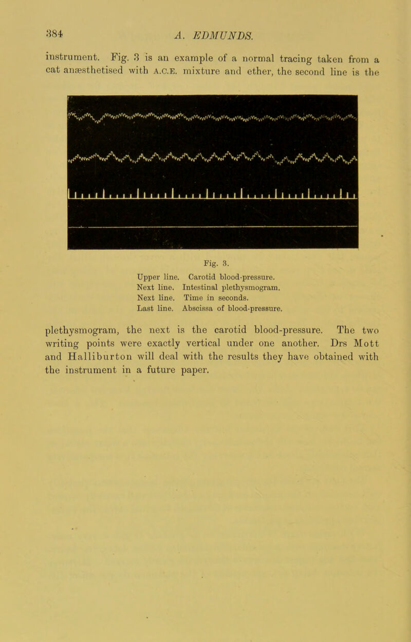 instrument. Fig. 3 is an example of a normal tracing taken from a cat anaesthetised with A.c.E. mixture and ether, the second line is the I i i I I i i i i I I i i I I i i i i I I i i I I i i i i I I i i l 1 i i i i i I i Fig- 3- Upper line. Carotid blood-pressure. Next line. Intestinal plethysmogram. Next line. Time in seconds. Last line. Abscissa of blood-pressure. plethysmogram, the next is the carotid blood-pressure. The two writing points were exactly vertical under one another. Drs Mott and Halliburton will deal with the results they have obtained with the instrument in a future paper.