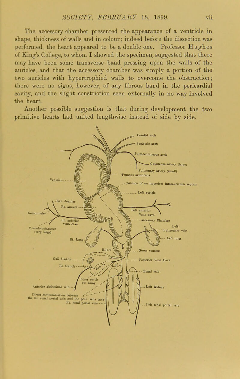 SOCIETY, FEBRUARY 18, 1899. Vll The accessory chamber presented the appearance of a ventricle in shape, thickness of walls and in colour; indeed before the dissection was performed, the heart appeared to be a double one. Professor Hughes of King’s College, to whom I showed the specimen, suggested that there may have been some transverse band pressing upon the walls of the auricles, and that the accessory chamber was simply a portion of the two auricles with hypertrophied walls to overcome the obstruction; there were no signs, however, of any fibrous band in the pericardial cavity, and the slight constriction seen externally in no way involved the heart. Another possible suggestion is that during development the two primitive hearts had united lengthwise instead of side by side.