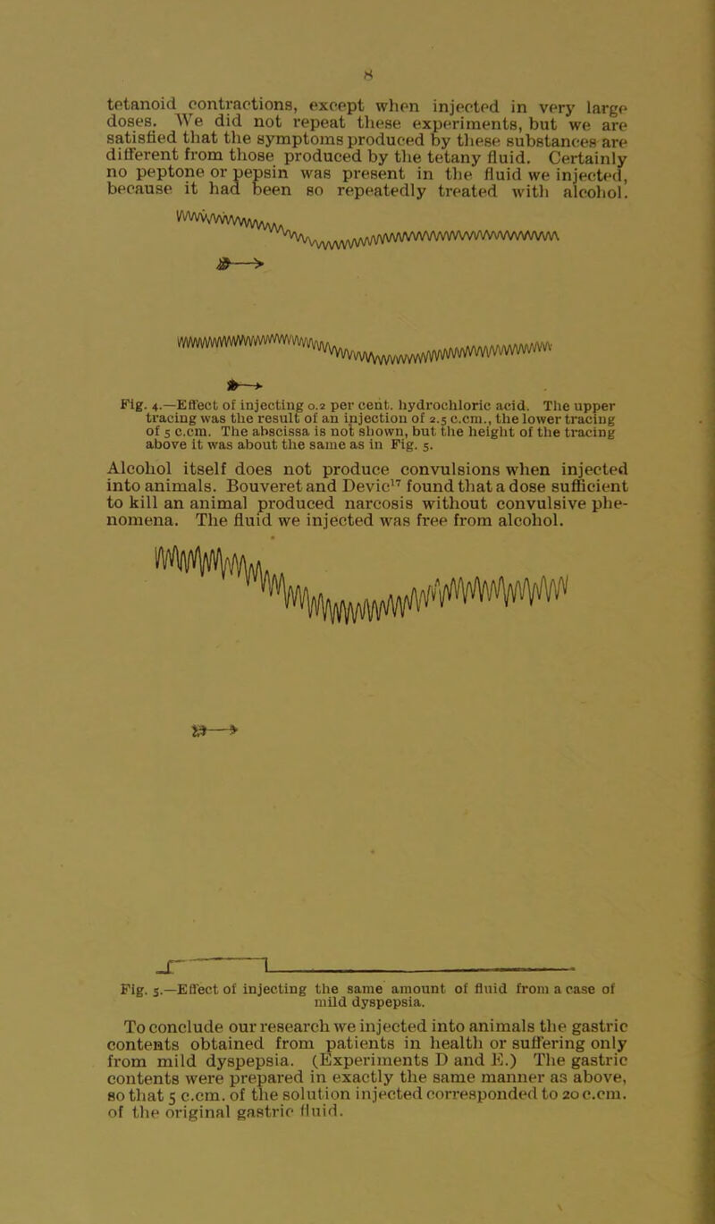 H tetanoid contractions, except when injected in very large doses. We did not repeat these experiments, but we are satisfied that the symptoms produced by these substances are different from those produced by the tetany fluid. Certainly no peptone or pepsin was present in the fluid we injected, because it had been so repeatedly treated with alcohol. vvvvvVvwvwvA^^ > Fig. 4.—Effect of injecting 0.2 per cent, hydrochloric acid. The upper tracing was the result of an injection of 2.5 c.cin., the lower tracing of 5 c.cin. The abscissa is not shown, but the height of the tracing above it was about the same as in Fig. 5. Alcohol itself does not produce convulsions when injected into animals. Bouveret and Devic17 found that a dose sufficient to kill an animal produced narcosis without convulsive phe- nomena. The fluid we injected was free from alcohol. _c 1 — —- Fig. 5.—Effect of injecting the same amount of fluid from a case of mild dyspepsia. To conclude our research we injected into animals the gastric contents obtained from patients in health or suffering only from mild dyspepsia. (Experiments D and E.) The gastric contents were prepared in exactly the same manner as above, so that 5 c.cm. of the solution injected corresponded to 2oc.cm. of the original gastric fluid. \