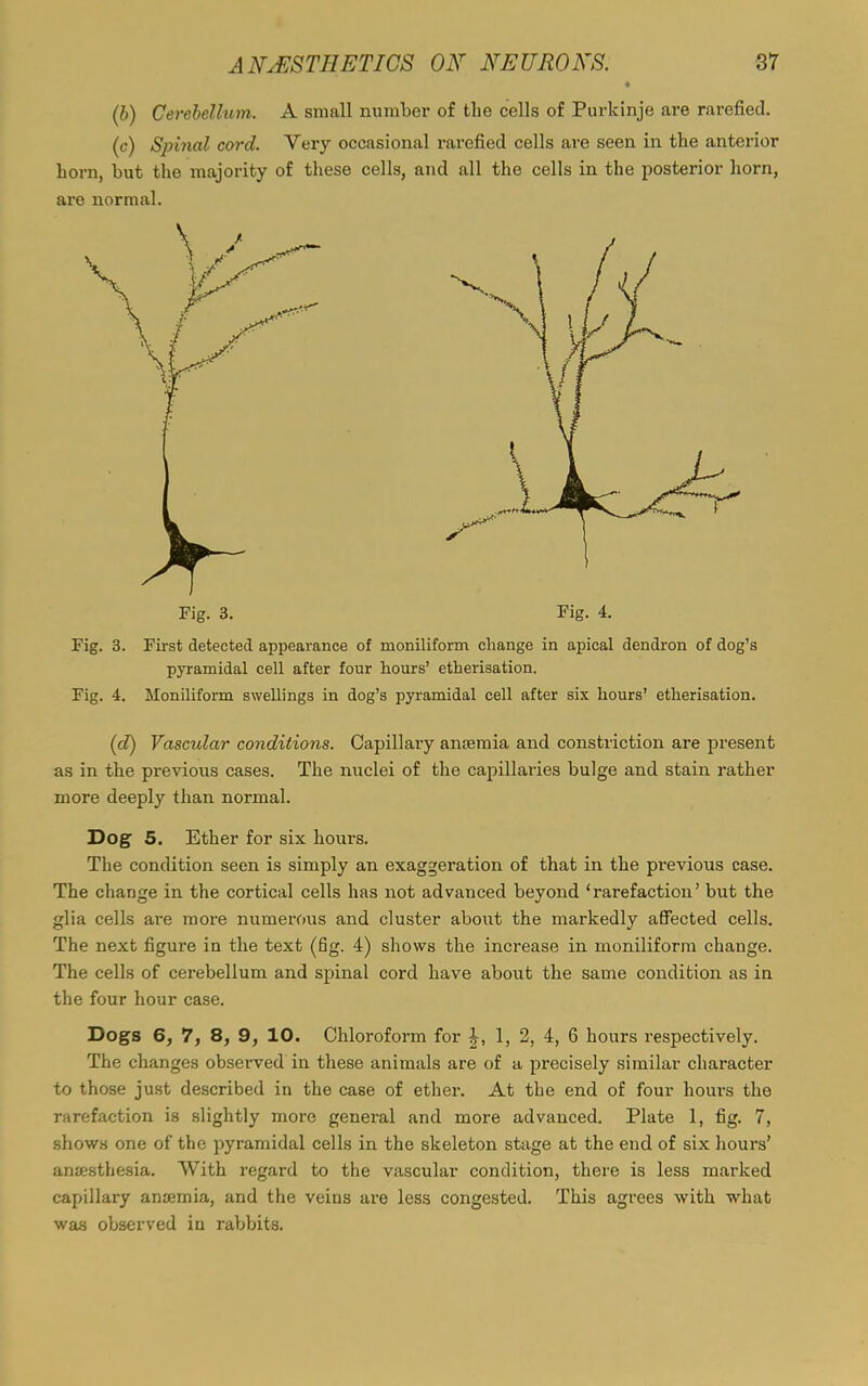 (b) Cerebellum. A small number of the cells of Purkinje are rarefied. (c) Spinal cord. Very occasional rarefied cells are seen in the anterior horn, but the majority of these cells, and all the cells in the posterior horn, are normal. Fig. 3. Fig. 4. Fig. 3. First detected appearance of moniliform change in apical dendron of dog’s pyramidal cell after four hours’ etherisation. Fig. 4. Moniliform swellings in dog’s pyramidal cell after six hours’ etherisation. (d) Vascular conditions. Capillary anaemia and constriction are present as in the previous cases. The nuclei of the capillaries bulge and stain rather more deeply than normal. Dog 5. Ether for six hours. The condition seen is simply an exaggeration of that in the previous case. The change in the cortical cells has not advanced beyond ‘rarefaction’ but the glia cells are more numerous and cluster about the markedly affected cells. The next figure in the text (fig. 4) shows the increase in moniliform change. The cells of cerebellum and spinal cord have about the same condition as in the four hour case. Dogs 6, 7, 8, 9, 10. Chloroform for 1, 2, 4, 6 hours respectively. The changes observed in these animals are of a precisely similar character to those just described in the case of ether. At the end of four hours the rarefaction is slightly more general and more advanced. Plate 1, fig. 7, shows one of the pyramidal cells in the skeleton stage at the end of six hours’ anaesthesia. With regard to the vascular condition, there is less marked capillary anaemia, and the veins are less congested. This agrees with what waus observed in rabbits.