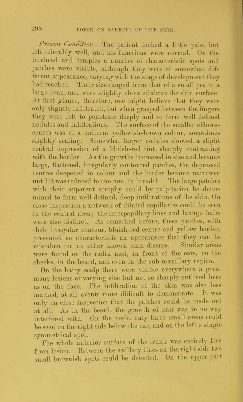 Present Condition.—The patient looked a little pale, but felt tolerably well, and liis functions were normal. On the forehead and temples a number of characteristic spots and patches were visible, although they were of somewhat dif- ferent appearance, varying with the stage of development they had reached. Their size ranged from that of a small pea to a large bean, and were slightly elevated above the skin surface. At first glance, therefore, one might believe that they were only slightly infiltrated, but when grasped between the fingers they were felt to penetrate deeply and to form well defined nodules and infiltrations. The surface of the smaller efflores- cences was of a uniform yellowish-brown colour, sometimes slightly scaling. Somewhat larger nodules showed a slight central depression of a bluish-red tint, sharply contrasting with the border. As the growths increased in size and became large, flattened, irregularly contoured patches, the depressed centres deepened in colour and the border became narrower until it was reduced to one mm. in breadth. The large patches with their apparent atrophy could by palpitation be deter- mined to form well defined, deep infiltrations of the skin. On close inspection a network of dilated capillaries could be seen in the central area; theinterpapillarylines and lanugo hairs were also distinct. As remarked before, these patches, with their irregular contour, bluish-red centre and yellow border, presented so characteristic an appearance that they can be mistaken for no other known skin disease. Similar areas were found on the radix nasi, in front of the ears, on the cheeks, in the beard, and even in the sub-maxillary region. On the hairy scalp there were visible everywhere a great many lesions of varying size but not so sharply outlined here as on the face. The infiltration of the skin was also less marked, at all events more difficult to demonstrate. It was only on close inspection that the patches could be made out at all. As in the beard, the growth of hair was in no way interfered with. On the neck, only three small areas could be seen on the right side below the ear, and on the left a single symmetrical spot. * The whole anterior surface of the trunk was entirely free from lesion. Between the axillary lines on the right side two small brownish spots could be detected. On the upper part