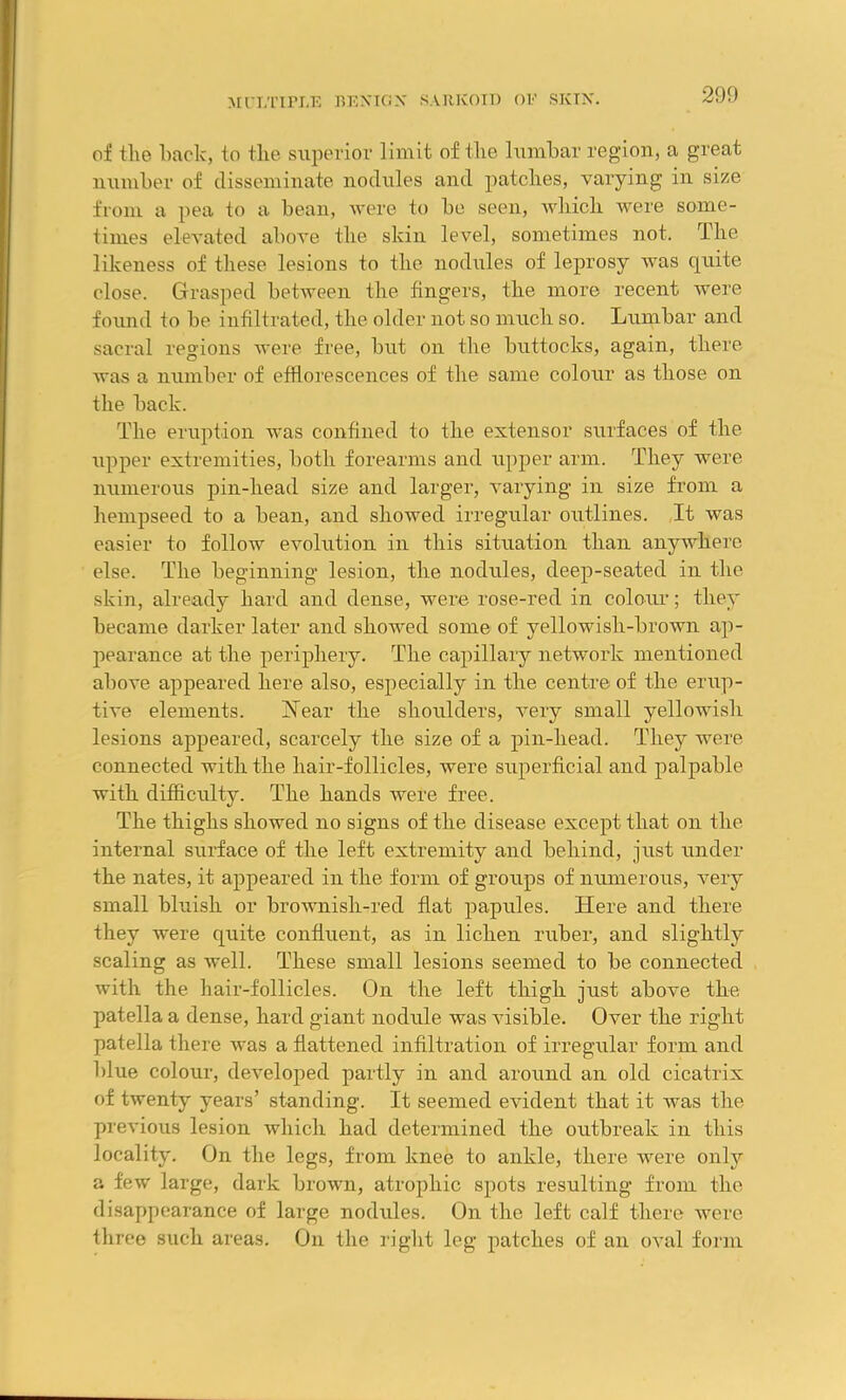 ol the back, to tlie superior limit of the lumbar region, a great number of disseminate nodules and patches, varying in size from a pea to a bean, were to be seen, which were some- times elevated above the skin level, sometimes not. The likeness of these lesions to the nodules of leprosy was quite close. Grasped between the fingers, the more recent were found to be infiltrated, the older not so much so. Lumbar and sacral regions were free, but on the buttocks, again, there was a number of efflorescences of the same colour as those on the back. The eruption was confined to the extensor surfaces of the upper extremities, both forearms and upper arm. They were numerous pin-head size and larger, varying in size from a hempseed to a bean, and showed irregular outlines. It was easier to follow evolution in this situation than anywhere else. The beginning lesion, the nodules, deep-seated in the skin, already hard and dense, were rose-red in colour; they became darker later and showed some of yellowish-brown ap- pearance at the periphery. The capillary network mentioned above appeared here also, especially in the centre of the erup- tive elements. Near the shoulders, very small yellowish lesions appeared, scarcely the size of a pin-head. They were connected with the hair-follicles, were superficial and palpable with difficulty. The hands were free. The thighs showed no signs of the disease except that on the internal surface of the left extremity and behind, just under the nates, it appeared in the form of groups of numerous, very small bluish or brownish-red flat papules. Here and there they were quite confluent, as in lichen ruber, and slightly scaling as well. These small lesions seemed to be connected with the hair-follicles. On the left thigh just above the patella a dense, hard giant nodule was visible. Over the right patella there was a flattened infiltration of irregular form and blue colour, developed partly in and around an old cicatrix of twenty years’ standing. It seemed evident that it was the previous lesion which had determined the outbreak in this locality. On the legs, from knee to ankle, there were only a few large, dark brown, atrophic spots resulting from the disappearance of large nodules. On the left calf there were three such areas. On the right leg patches of an oval form