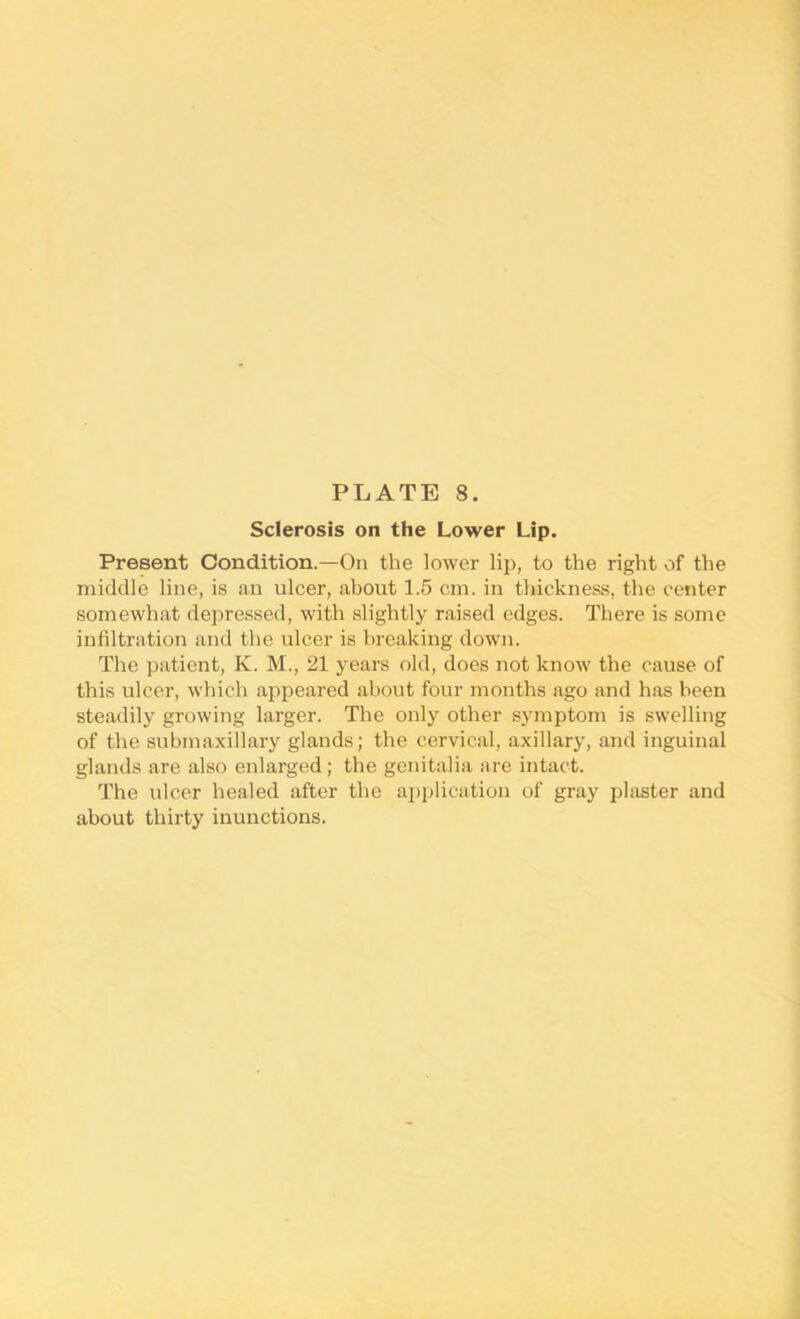 Sclerosis on the Lower Lip. Present Condition.—On the lower lip, to the right of the middle line, is an ulcer, about 1.5 cm. in thickness, the center somewhat depressed, with slightly raised edges. There is some infiltration and the ulcer is breaking down. The patient, K. M., 21 years old, does not know the cause of this ulcer, which appeared about four months ago and has been steadily growing larger. The only other symptom is swelling of the submaxillary glands; the cervical, axillary, and inguinal glands are also enlarged; the genitalia are intact. The ulcer healed after the a2)plication of gray plaster and about thirty inunctions.
