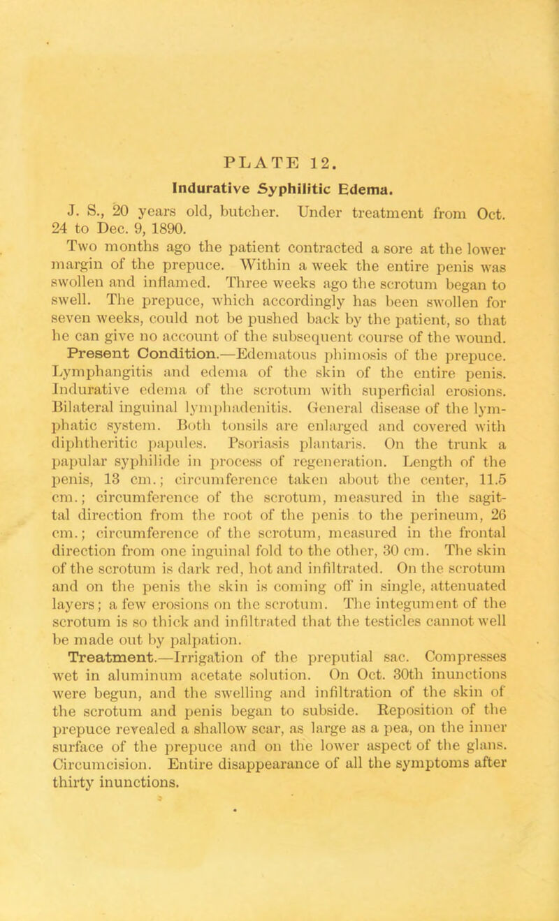 Indurative Syphilitic Edema. J. S., 20 years old, butcher. Under treatment from Oct. 24 to Dec. 9, 1890. Two months ago the patient contracted a sore at the lower margin of the prepuce. Within a week the entire penis was swollen and inflamed. Three weeks ago the scrotum began to swell. The prepuce, which accordingly has been swollen for seven weeks, could not be pushed back by the patient, so that he can give no account of the subsequent course of the wound. Present Condition.—Edeniatous phimosis of the prepuce. Lymphangitis and edema of the skin of the entire penis. Indurative edema of the scrotum with superficial erosions. Bilateral inguinal lymphadenitis. General disease of the lym- phatic system. Both tonsils are enlarged and covered with diphtheritic papules. Psoriasis plantaris. On the trunk a papular syphilide in process of regeneration. Length of the j:»enis, 13 cm.; circumference taken about the center, 11.5 cm.; circumference of the scrotum, measured in the sagit- tal direction from the root of the penis to the perineum, 26 cm.; circumference of the scrotum, measured in the frontal direction from one inguinal fold to the other, 30 cm. The skin of the scrotum is dark red, hot and infiltrated. On the scrotum and on the penis the skin is coming off in single, attenuated layers; a few erosions on the scrotum. The integument of the scrotum is so thick and infiltrated that the testicles cannot well be made out by palpation. Treatment.—Irrigation of the preputial sac. Compresses wet in aluminum acetate solution. On Oct. 30th inunctions were begun, and the swelling and infiltration of the skin of the scrotum and penis began to subside. Reposition of the prepuce revealed a shalloAV scar, as large as a pea, on the inner surface of the prepuce and on the low'er aspect of the glans. Circumcision. Entire disappearance of all the symptoms after thirty inunctions.