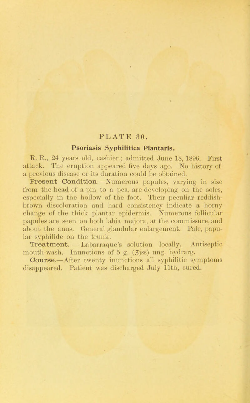 Psoriasis Syphilitica Plantaris. R. R., 24 years old, cashier; admitted June 18, 1896. First attack. The eruption appeared five days ago. No history of a previous disease or its duration could be ol)tained. Present Condition.—Numerous i)apules, varying in .size from the head of a pin to a pea, are developing on the soles, especially in the hollow of the foot. Their peculiar reddish- brown discoloration and hard consi.stency indicate a horny change of the thick plantar epidermis. Niunerous follicular papules are seen on both labia majora, at the commi.ssure, and about the anus. General glandular enlargement. Pale, paj)U- lar syphilide on the trunk. Treatment. — Labarraque’s solution locally. Antiseptic mouth-wash. Inunctions of 5 g. (.^jss) ung. hydrarg. Course.—After twenty inunctions all syphilitic syinptoms disappeared. Patient was discharged July 11th, cured.