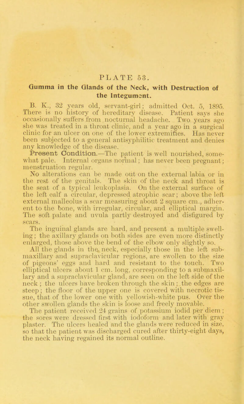 Gumma in the Glands of the Neck, with Destruction of the Integument. B. K., 32 years old, servant-girl; admitted Oct. 6, 1895. There is no history of hereditary disease. Patient says she occa.sionally sutlers from nocturnal headache. Two years ago she was treated in a throat clinic, and a year ago in a surgical clinic for an ulcer on one of the lower extremities. Has never been subjected to a general antisyphilitic treatment and denies any knowledge of the disease. Present Condition.—The patient is well nourished, some- what pale. Internal organs normal; has never been pregnant; menstruation regular. No alterations can be made out on the external labia or in the rest of the genitals. The skin of the neck and throat is the seat of a typical leukoplasia. On the external surface of the left calf a circular, depressed atrophic scar; above the left external malleolus a scar measuring about 2 square cm., adher- ent to the bone, with irregular, circular, and elliptical margin. The soft palate and uvula partly destroj^ed and disfigured bj' scars. The inguinal glands are hard, and present a multiple swell- ing; the axillary glands on both sides are even more distinctly enlarged, those above the hend of the elbow only .slightly so. All the glands in the» neck, especially those in the left sub- maxillary and sui>raclavicular regions, ai’e swollen to the size of pigeons’ eggs and hard and resistant to the touch. Two elliptical ulcers about 1 cm. long, corresponding to a submaxil- lary and a supraclavicular gland, are seen on the left side of the neck ; the ulcers have hroken through the skin ;_the edges are steep; the Hoor of the upper one is covered with necrotic tis- sue, that of the lower one with yellowi.sh-white pus. Over the other swollen glands the skin is loose and freely movable. The patient received 24 grains of potassium iodid per diem ; the sores were dressed flr.st with iodoform and later with gray pla.ster. The ulcers healed and the glands were reduced in size, so that the patient was discharged cured after thirty-eight days, the neck having regained its normal outline.