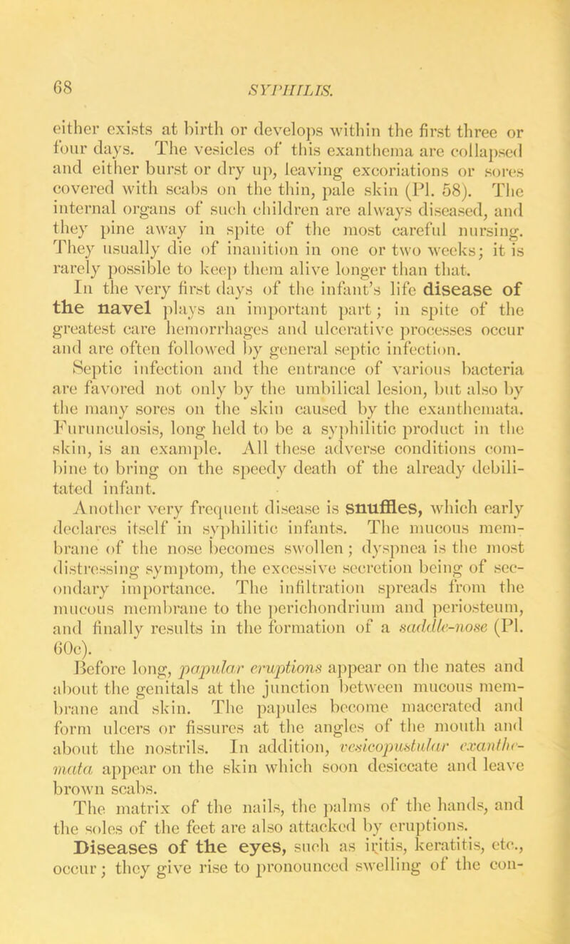 oither exists at birth or develops Avithin the first three or four clays. The vesicles of this exanthema arc collapsed and either burst or dry up, leaving excoriations or sores covered with scabs on the thin, pale skin (PI. 58). The internal organs of such children are always diseased, and they pine away in spite of the most careful nursing. They usually die of inanition in one or two Aveeks; it is rarely possible to keep them ali\’e longer than that. In the A^ery first days of the infant’s life disease of the navel ]days an important part; in spite of the greatest care hemorrhages and ulcerative processes occur and are often followed by general septic infection. Septic infection and the entrancje of A'arious bacteria are favored not only by the umbilical lesion, but also by the many sores on the skin caused by the exanthemata. Furunculosis, long held to be a sy])hilitic product in the skin, is an example. 7VII these adverse conditions com- bine to bring on the speedy death of the already debili- tated infant. Another very frequent disease is snuffles, Avhich early declares itself in syphilitic infants. The mucous mem- brane of the nose becomes swollen; dyspnea is the most distressing symptom, the excessive secretion being of sec- ondary importance. The infiltration spreads from the mucous membrane to the perichondrium and periosteum, and finally results in the formation of a scukUe-nose (PI. 60c). Before long, popular eruptions appear on the nates and about the genitals at the junction betAveen mucous mem- brane and skin. The pajAules become macerated and form ulcers or fissures at the angles of the mouth and about the nostrils. In addition, vcsicopustular exanthe- mata appear on the skin Avhich soon desiccate and leaA'c broAvn scabs. The matrix of the nails, the palms of the hands, and the soles of the feet are also attacked by eruptions.^ Diseases of the eyes, such as ii^itis, keratitis, etc., occur; they gi\’e rise to pi’onounccd sAvelliug of the con-