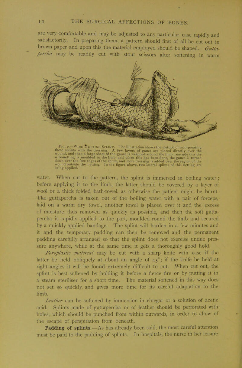 are very comfortable and may be adjusted to any particular case rapidly and .satisfactorily. In preparing them, a pattern should first of all be cut out in brown paper and upon this the material employed should be shaped. Gutta- percha may be readily cut with stout scissors after softening in warm Fic. 2.^—WiRE'^ETTiNG Si'LiNT. 'I’he illustration shows the method of incorporating these splints with the dressing. A few layers of gauze are placed directly over the wound, and t hen a large sheet of the gauze is wrapped around the limb ; outside this the wire-netting is moulded to the Hmb, and when this has been done, the gauze is turned down over the free edges of the splint, and more dressing is added over the region of the wound outside the netting. In the figure above, two lateral splints of this netting are being applied. water. AVhen cut to the pattern, the splint is immersed in boiling water; before applying it to the limb, the latter should be covered by a layer of wool or a thick folded bath-towel, as otherwise the patient might be burnt. 'I'he guttapercha is taken out of the boiling water with a pair of forceps, laid on a warm dry towel, another towel is placed over it and the excess of moisture thus removed as quickly as possible, and then the soft gutta- percha is rapidly applied to the part, moulded round the limb and secured by a quickly applied bandage. The splint will harden in a few minutes and it and the temporary padding can then be removed and the permanent padding carefully arranged so that the splint does not exercise undue pres- sure anywhere, while at the same time it gets a thoroughly good hold. Poroplastic material may be cut with a sharp knife with ease if the latter be held obliquely at about an angle of 45°; if the knife be held at right angles it will be found extremely difficult to cut. When cut out, the splint is best softened by holding it before a fierce fire or by putting it in a steam steriliser for a short time. The material softened in this way does not set so quickly, and gives more time for its careful adaptation to the limb. Leather can be softened by immersion in vinegar or a solution of acetic acid. Splints made of guttapercha or of leather should be perforated with holes, which should be punched from within outwards, in order to allow of the escape of perspiration from beneath. Padding of splints.—As has already been said, the most careful attention must be paid to the padding of splints. In hospitals, the nur.se in her leisure