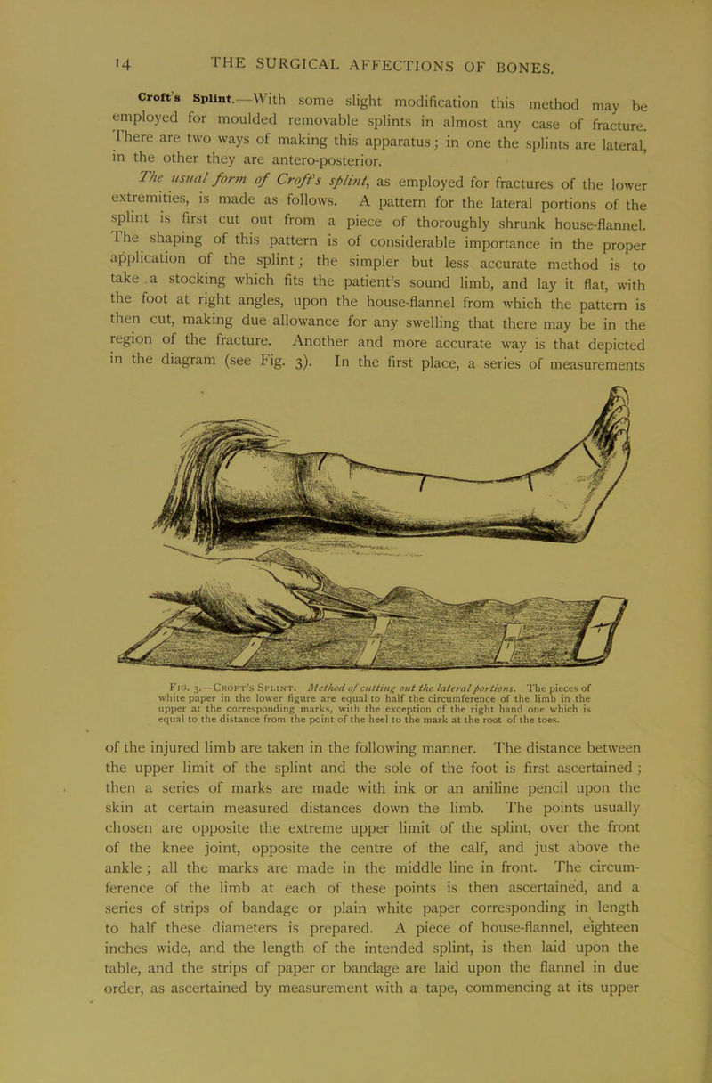 Crofts Splint.—With some slight modification this method may be employed for moulded removable splints in almost any case of fracture. 1 here are two ways of making this apparatus; in one the splints are lateral, in the other they are antero-posterior. The usual form of Croffs sflmt, as employed for fractures of the lower extremities, is made as follows. A pattern for the lateral portions of the splint is first cut out from a piece of thoroughly shrunk house-flannel. The shaping of this pattern is of considerable importance in the proper application of the splint; the simpler but less accurate method is to take.a stocking which fits the patient’s sound limb, and lay it flat, with the foot at right angles, upon the house-flannel from which the pattern is then cut, making due allowance for any swelling that there may be in the region of the fracture. Another and more accurate way is that depicted in the diagram (see Fig. 3). In the first place, a series of measurements FJio. 3.—Croft's Splint. Meihcd of cutting out the lateral portions. The pieces of white paper in the lower figure are equal to half the circumference of the limb in the upper at the corresponding marks, with the e.xception of the right hand one which is equal to the distance from the point of the heel to the mark at the root of the toes. of the injured limb are taken in the following manner. The distance between the upper limit of the splint and the sole of the foot is first ascertained ; then a series of marks are made with ink or an aniline pencil upon the skin at certain measured distances down the limb. The points usually chosen are opposite the extreme upper limit of the splint, over the front of the knee joint, opposite the centre of the calf, and just above the ankle; all the marks are made in the middle line in front. The circum- ference of the limb at each of these points is then ascertained, and a series of strips of bandage or plain white paper corresponding in length to half these diameters is prepared. A piece of house-flannel, eighteen inches wide, and the length of the intended .splint, is then laid upon the table, and the strips of paper or bandage are laid upon the flannel in due order, as ascertained by measurement with a tape, commencing at its upper