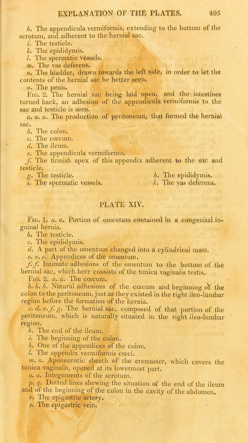 h. The appendicula vermiformis, extending to the bottom of the scrotum, and adherent to the hernial sac. i. The testicle. k. The epididymis. l. The spermatic vessels. m. The vas deferens. n. The bladder, drawn towards the left side, in order to let the contents of the hernial sac be better seen. o. The penis. Fig. 2. The hernial sac being laid open, and the intestines turned back, an adhesion of the appendicula vermiformis to the sac and testicle is seen. a. a. a. The production of peritoneum, that formed the hernial sac. b. The colon. c. The caecum. d. The ileum. e. The appendicula vermiformis. f The firmish apex of this appendix adherent to the Sac and Fig. 1. a. a. Portion of omentum contained in a congenital in* guinal hernia. b. The testicle. c. The epididymis. d. A part of the omentum changed into a cylindrical mass. e. e. e. Appendices of the omentum. f.f. Intimate adhesions of the omentum to the bottom of the hernial sac, which here consists of the tunica vaginalis testis. Fig. 2. a. a. The coecum. b. b. b. Natural adhesions of the coecum and beginning oY the colon to the peritoneum, just as they existed in the right ileo-lumbar region before the formation of the hernia. c. d. e.f. g. The hernial sac, composed of that portion of the peritoneum, which is naturally situated in the right ileo-lumbar region. h. The end of the ileum. i. The beginning of the colon. Ic. One of the appendices of the colon. 1. The appendix vermiformis cceci. w.. n. Aponeurotic sheath of the cremaster, which covers the tunica vaginalis, opened at its lowermost part. o. o. Integuments of the scrotum. p. q. Dotted lines shewing the situation of the end of the ileum and of the beginning of the colon in the cavity of the abdomen. r. The epigastric artery. s. The epigastric vein. testicle. g. The testicle. z. The spermatic vessels. h. The epididymis. k. The vas deferens. PLATE XIV.