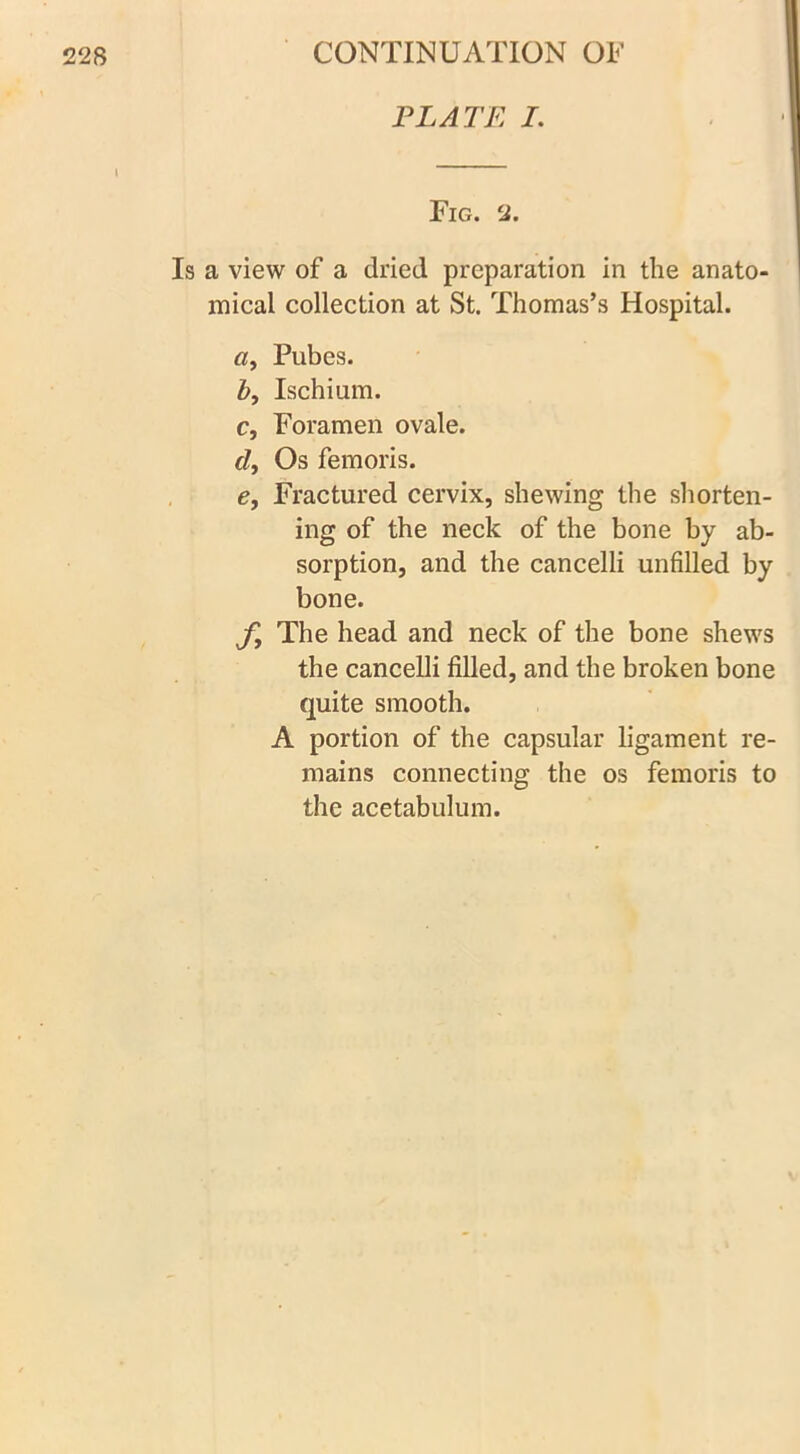 PLATE I. Fig. 2. Is a view of a dried preparation in the anato- mical collection at St. Thomas’s Hospital. «, Pubes. b, Ischium. c, Foramen ovale, r/. Os femoris. e. Fractured cervix, shewing the shorten- ing of the neck of the bone by ab- sorption, and the cancelli unfilled by bone. f. The head and neck of the bone shews the cancelli filled, and the broken bone quite smooth. A portion of the capsular ligament re- mains connecting the os femoris to the acetabulum.