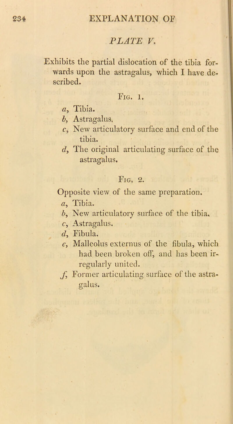 PLATE V. Exhibits the partial dislocation of the tibia for- wards upon the astragalus, which I have de- scribed. Fig. 1. a. Tibia. b, Astragalus. c. New articulatory surface and end of the tibia. d, The original articulating surface of the astragalus. Fig, 2. Opposite view of the same preparation. a, Tibia. b, New articulatory surface of the tibia. c, Astragalus. d, Fibula. e> Malleolus externus of the fibula, which had been broken off, and has been ir- regularly united. Jl Former articulating surface of the astra- galus.