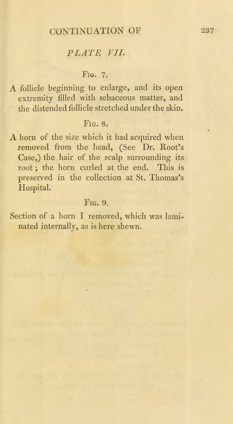 PLATE VII. Fig. 7. A follicle beginning to enlarge, and its open extremity filled with sebaceous matter, and the distended follicle stretched under the skin. Fig. 8. A horn of the size which it had acquired when removed from the head, (See Dr. Root’s Case,) the hair of the scalp surrounding its root; the horn curled at the end. This is preserved in the collection at St. Thomas’s Hospital. Fig. 9. Section of a horn I removed, which was lami- nated internally, as is here shewn.