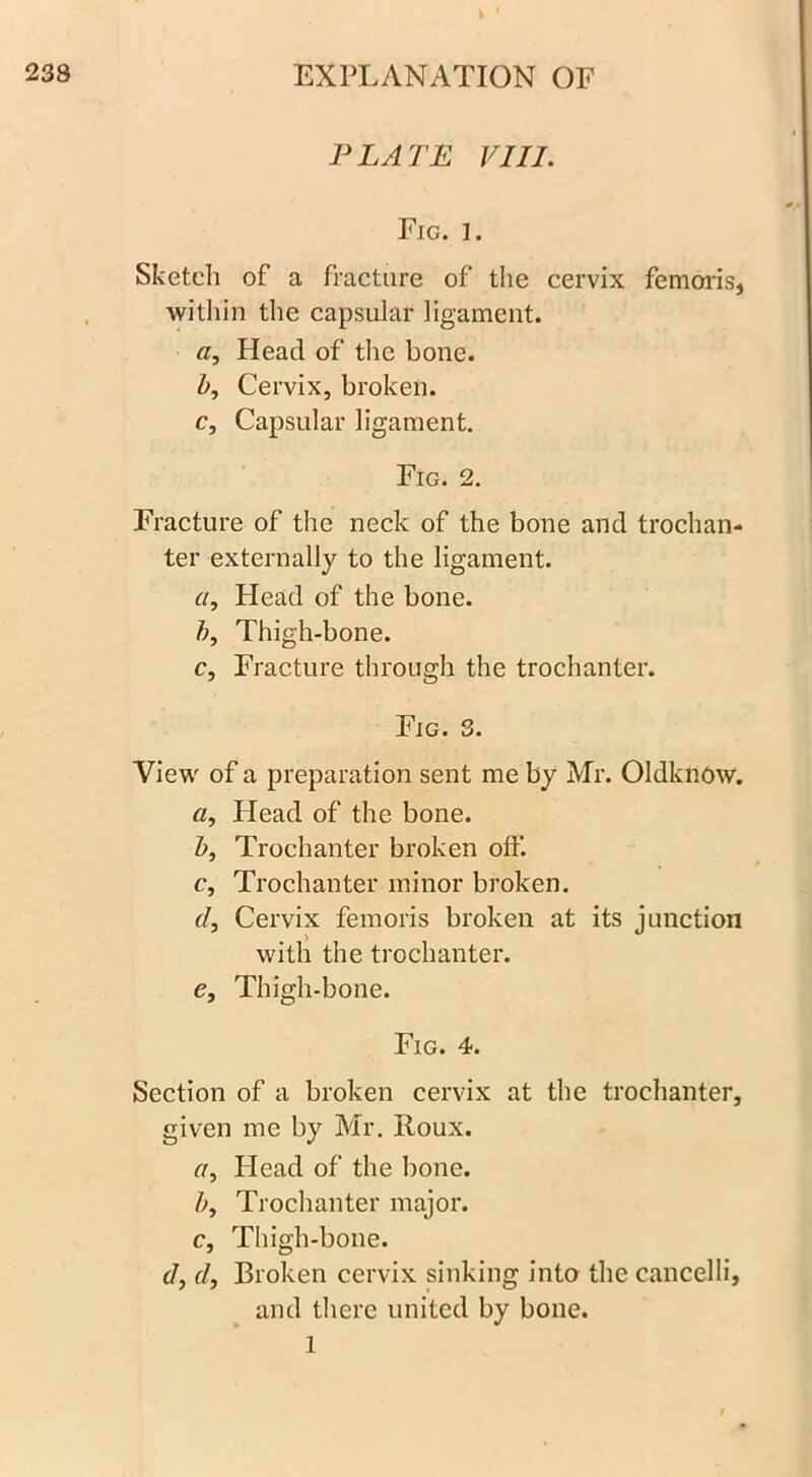 PLATE VIII. Fig. 1. Sketch of a fracture of the cervix femoris, within the capsular ligament. a, Head of the bone. b, Cervix, broken. c, Capsular ligament. Fig. 2. Fracture of the neck of the bone and trochan- ter externally to the ligament. a, Head of the bone. b, Thigh-bone. c, Fracture through the trochanter. Fig. 3. View of a preparation sent me by Mr. Oldknow. a, Head of the bone. Z>, Trochanter broken off. c, Trochanter minor broken. d, Cervix femoris broken at its junction with the trochanter. e, Thigh-bone. Fig. 4. Section of a broken cervix at the trochanter, given me by Mr. Iloux. r/, Plead of the bone. b, Trochanter major. c, Thigh-bone. d, d, Broken cervix sinking into the cancelli, and there united by bone, l