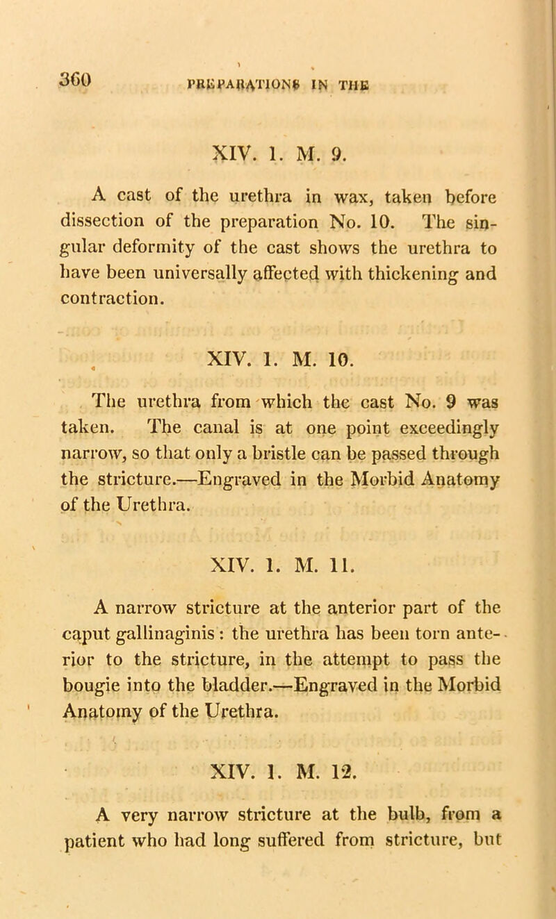 3(50 I’HliyAHATlONe IN THE XIV. 1. M. 9. A cast of the urethra in wax, taken before dissection of the preparation No. 10. The sin- gular deformity of the cast shows the urethra to have been universally affected with thickening and contraction. XIV. 1. M. 10. The urethra from which the cast No. 9 was taken. The canal is at one point exceedingly narrow, so that only a bristle can be passed through the stricture.—Engraved in the Morbid Anatomy of the Urethra. '■s XIV. 1. M. 11. A narrow stricture at the anterior part of the caput gallinaginis : the urethra has been torn ante- • rior to the stricture, in the attempt to pass the bougie into the bladder.—Engraved in the Morbid Anatomy of the Urethra. XIV. 1. M. 12. A very narrow stricture at the bulb, from a patient who had long suffered from stricture, but