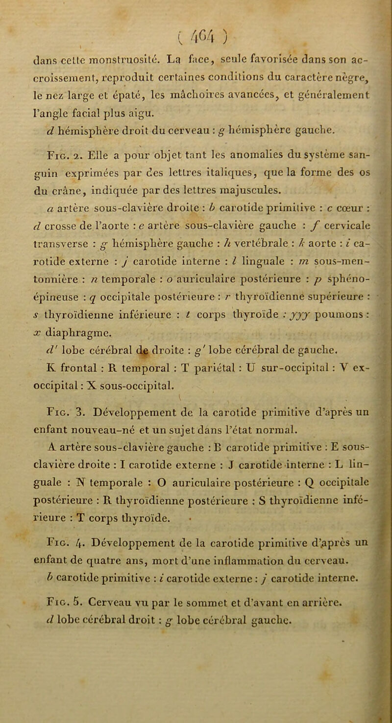 ( /.G/l ) clans celle monstruosité. La face, seule favorisée dans son ac- croissement, repi'oduit certaines conditions du caractère nègre, le nez large et épaté, les mâchoires avancées, et généralement l’angle facial plus aigu. d hémisphère droit du cerveau : g hémisphère gauche. Fig. 2. Elle a pour objet tant les anomalies du système san- guin exprimées par des lettres italicj[ues, que la forme des os du crâne, indiquée par des lettres majuscules. a artère sous-clavière droite : h carotide primitive : c cœur : d crosse de l’aorte : e artère sous-clavière gauche : f cervicale Iransverse : g hémisphère gauche : h vertébrale : h aorte : i ca- rotide extei’ne : j carotide interne : l linguale : m sous-men- tonnière : n temporale : o auriculaire postérieure : p sphéno- épineuse : q occipitale postérieure : r thyroïdienne supérieure : s thyroïdienne inférieure : t corps thyroïde : yyy poumons : X diaphragme. d'lobe cérébral (le droite : g' lobe cérébral de gauche. K frontal : R temporal ; T pariétal : U sur-occipital : V ex- occipital : X sous-occipital. t Fio. 3. Développement de la carotide primitive d’après un enfant nouveau-né et un sujet dans l’état normal. A artère sous-clavière gauche : B carotide primitive ; E sous- clavière droite : I carotide externe : J carotide interne : L lin- guale : N temporale : O auriculaire postérieure : Q occipitale postérieure : R thyroïdienne postérieure : S thyroïdienne infé- rieure : T corps thyroïde. il Fig. 4. Développement de la carotide primitive d’Api’cs un enfant de quatre ans, mort d’une inflammation du cerveau. b carotide primitive : i carotide externe : j carotide interne. Fig. 5. Cerveau vu par le sommet et d’avant en arrière. d lobe cérébral droit : g lobe cérébral gauche.