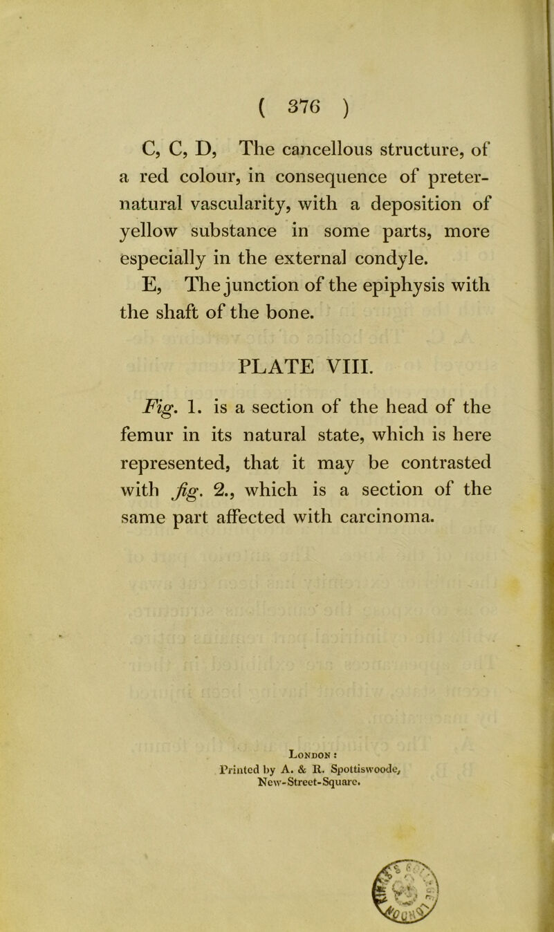 C, C, D, The cancellous structure, of a red colour, in consequence of preter- natural vascularity, with a deposition of yellow substance in some parts, more especially in the external condyle. E, The junction of the epiphysis with the shaft of the bone. PLATE VIII. Fig. 1. is a section of the head of the femur in its natural state, which is here represented, that it may be contrasted with Jig. 2., which is a section of the same part affected with carcinoma. London: Printed by A. & R. Spottiswoode, New- Street- Square.