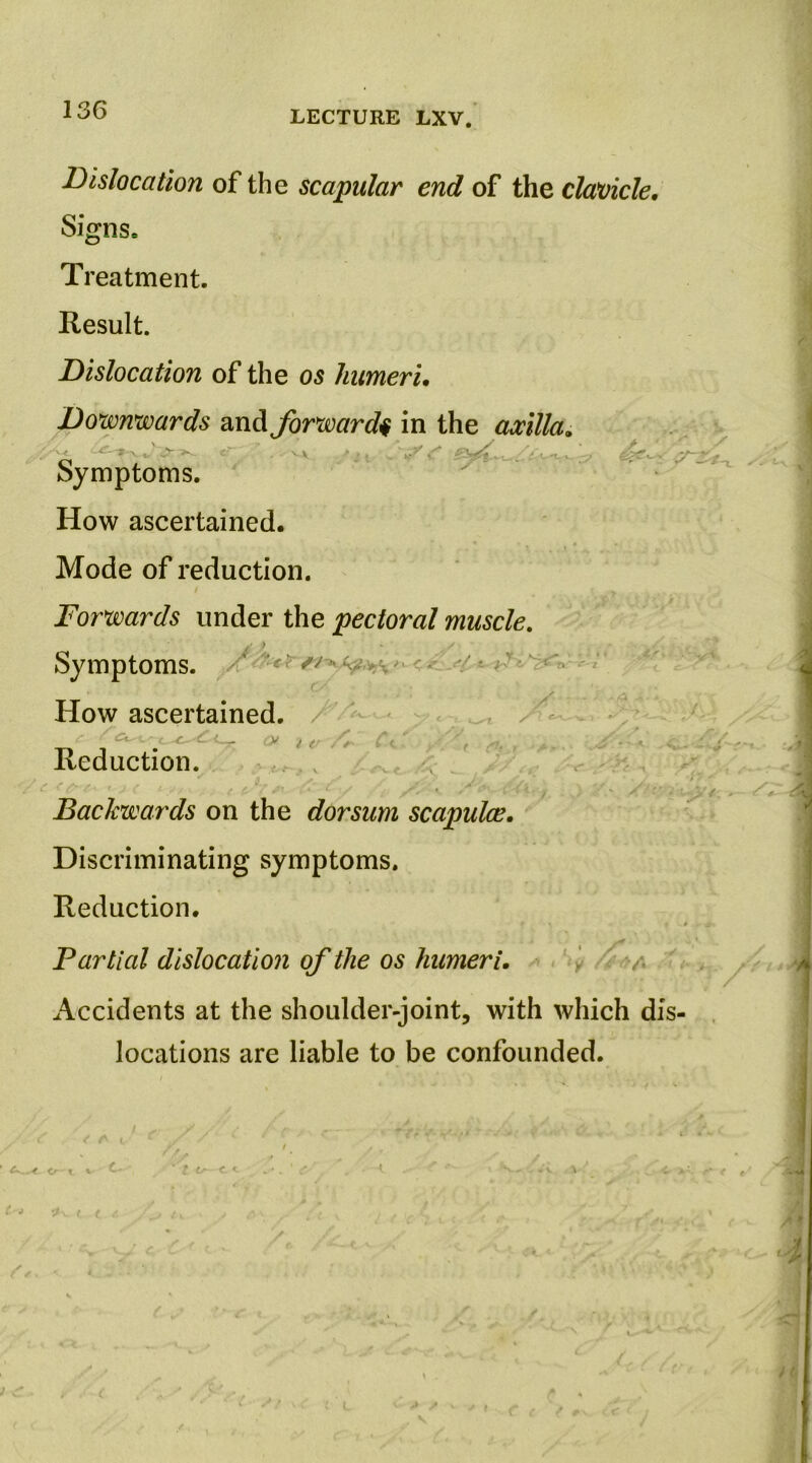 136 Dislocation of the scapular end of the clavicle. Signs. Treatment. Result. Dislocation of the os humeri. Downwards 2indi forward^ in the axilla. Symptoms. ' ’ ^ • How ascertained. Mode of reduction. Forwards \mdiOX the pectoral muscle, Symptoms. / < f ■' How ascertained. / ' - / ,, X ' ‘='’ <5:- ^ C o/ f Reduction. / ( i- y y. Backwards on the dorsum scapulce. Discriminating symptoms. Reduction. # • Partial dislocation of the os humeri, - ' v ^ . Accidents at the shoulder-joint, with which dis- locations are liable to be confounded. * <i K ( J •} I ( d - C <- <1