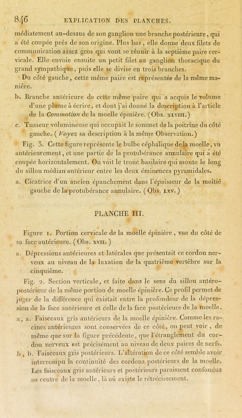 médiatement au-dessus de son ganglion une branche postérieure, qui a été coupée près de son origine. Plus bas , elle donne deux filets de communication assez gros qui vont se réunir à la septième paire cer- vicale. Elle envoie ensuite un petit fdet au ganglion thoracique du grand sympathique, puis elle se divise en trois branches. Du coté gauche, cette même paire est représentée de la même ma- nière. b. Branche antérieure de cette même paire qui'a acquis le volume d’une plume à écrire, et dont j’ai donné la description à l’article de la Commotion de la moelle épinière. (Obs. xlviii.) c. Tumeur volumineuse qui occupait le sommet de la poitrine du coté gauche. ( Voyez sa description à la même Observation.) Fig. 3. Cette figure représente le bulbe céphalique de la moelle, vu antérieurement, et une partie de la protubérance annulaire qui a été coupée horizontalement. On voit le tronc basilaire qui monte le long du sillon médian antérieur entre les deux éminences pyramidales. a. Cicatrice d’un ancien épanchement dans l’épaisseur de la moitié gauche de la protubérance annulaire. ( Obs. txv. ) PLANCHE III. Figure i. Portion cervicale de la moelle épinière , vue du côté de sa face antérieure. (Obs. xvir. ) a. Dépressions antérieures et latéi’ales que présentait ce cordon ner- veux au niveau de la luxation de la quatrième vertèbre sur la cinquième. Fig. 2. Section verticale, et faite dans le sens du sillon antéro- postérieur de la même portion de moelle épinière. Ce profil permet de juger de la différence qui existait entre la profondeur de la dépres- sion de la face antérieure et celle de la face postérieure de la moelle, a, a. Faisceaux gris antérieurs de la moelle épinière. Comme les ra- cines antérieures sont conservées de ce côté, on peut voir, de même que sur la figure précédente, que l’étranglement du cor- don nerveux est précisément au niveau de deux paires de nerfs, b , b. Faisceaux gris postérieurs. L'altération de ce côté semble avoir interrompu la continuité des cordons postérieurs de la moelle. Les faisceaux gris antérieurs et postérieurs paraissent confondus au centre de la moelle, là où existe le rétrécissement.