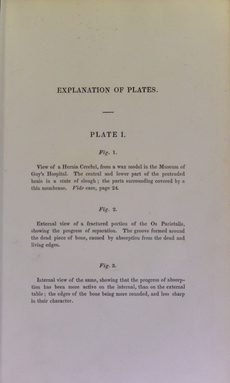 EXPLANATION OF PLATES. PLATE I. Fig. 1. View of a Hernia Cerebri, from a wax model in the Museum of Guy’s Hospital. The central and lower part of the protruded brain in a state of slough ; the parts surrounding covered by a thin membrane. Fide case, page 24. Fig. 2. External view of a fractured portion of the Os Parietalis, showing the progress of separation. The groove formed around the dead piece of hone, caused by absorption from the dead and living edges. Fig. 3. Internal view of the same, showing that the progress of absorp- tion has been more active on the internal, than on the external table; the edges of the bone being more rounded, and less sharp in their character.