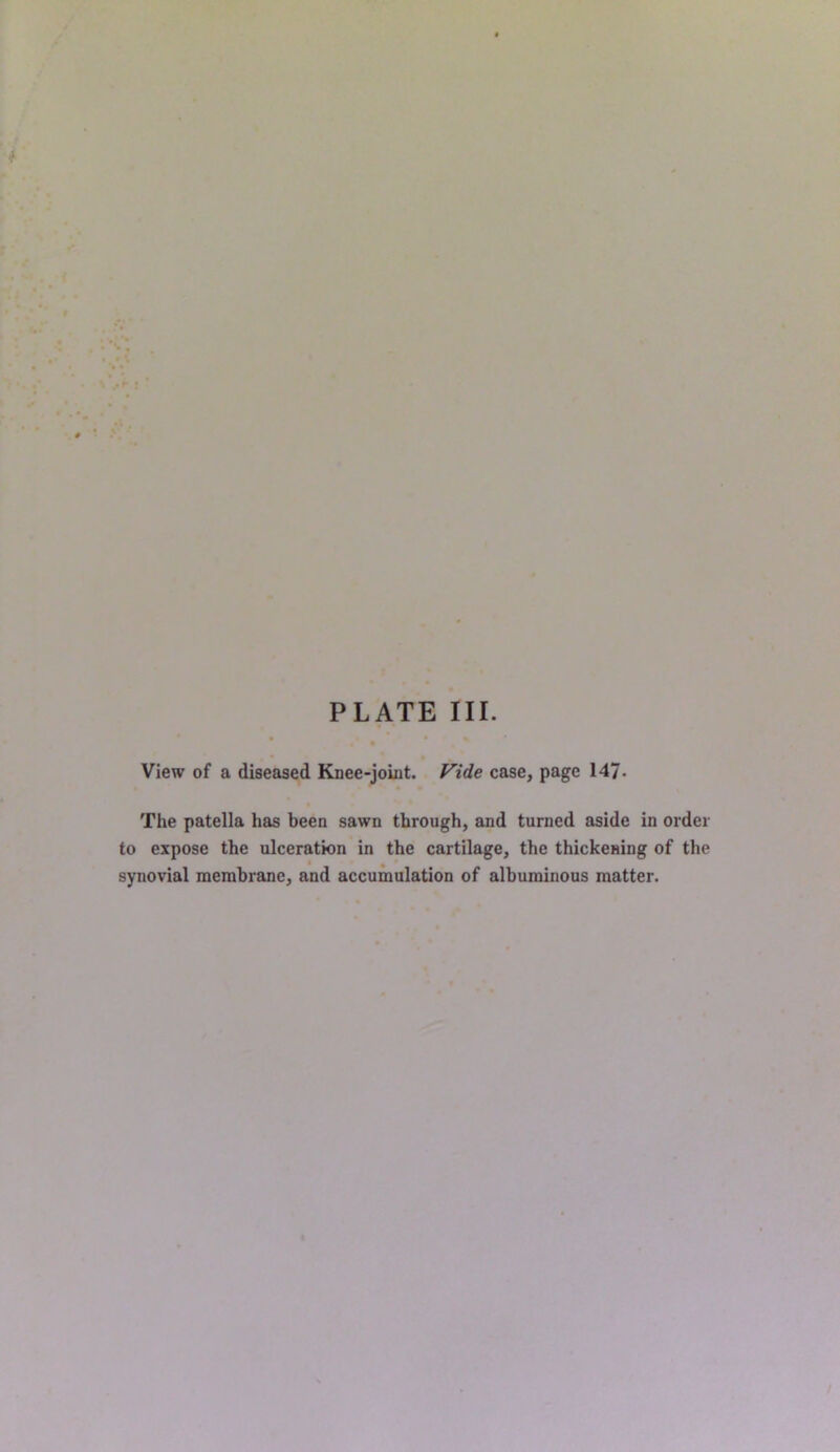 • • View of a diseased Knee-joint. Vide case, page 147- « The patella has been sawn through, and turned aside in order to expose the ulceration in the cartilage, the thickening of the • * synovial membrane, and accumulation of albuminous matter.