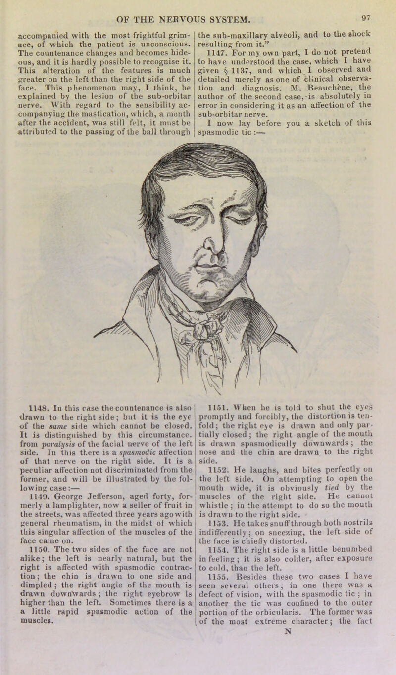 accompanied with the most frightful grim- ace, of which the patient is unconscious. The countenance changes and becomes hide- ous, and it is hardly possible to recognise it. This alteration of the features is much greater on the left than the right side of the face. This phenomenon may, I think, be explained by the lesion of the sub-orbitar nerve. With regard to the sensibility ac- companying the mastication, which, a month after the accident, was still felt, it must be attributed to the passing of the ball through the sub-maxillary alveoli, and to the shock resulting from it.” 1147. For my own part, I do not pretend to have understood the case, which I have given § 1137, and which I observed and detailed merely as one of clinical observa- tion and diagnosis. M. Beauchene, the author of the second case, is absolutely iu error in considering it as an affection of the sub-orbitar nerve. I now lay before you a sketch of this spasmodic tic:— V I1] fw • n ' 1 ' Wx f 1148. In this case the countenance is also drawn to the right side; but it is the eye of the same side which cannot be closed. It is distinguished by this circumstance, from paralysis of the facial nerve of the left side. In this there is a spasmodic affection of that nerve on the right side. It is a peculiar affection not discriminated from the former, and will be illustrated by the fol- lowing case:— 1149. George Jefferson, aged forty, for- merly a lamplighter, now a seller of fruit in the streets, was affected three years ago w ith general rheumatism, in the midst of which this singular affection of the muscles of the face came on. 1150. The two sides of the face are not | alike; the left is nearly natural, but the right is affected with spasmodic contrac- tion; the chin is drawn to one side and dimpled ; the right angle of the mouth is drawn down\vards ; the right eyebrow Is higher than the left. Sometimes there is a a little rapid spasmodic action of the muscles. 1151. When he is told to shut the eyes promptly and forcibly, the distortion is ten- fold ; the right eye is drawn and only par- tially closed ; the right angle of the mouth is drawn spasmodically downwards; the nose and the chin are drawn to the right side. 1152. He laughs, and bites perfectly on the left side. On attempting to open the mouth wide, it is obviously tied by the muscles of the right side. He cannot whistle; in the attempt to do so the mouth is drawn to the right side. 1153. He takes snuff through both nostrils indifferently; on sneeziug, the left side of the face is chiefly distorted. 1154. The right side is a little benumbed in feeling; it is also colder, after exposure to cold, than the left. 1155. Besides these two cases I have seen several others; in one there was a defect of vision, with the spasmodic tic ; in another the tic was confined to the outer portion of the orbicularis. The former was of the most extreme character; the fact N