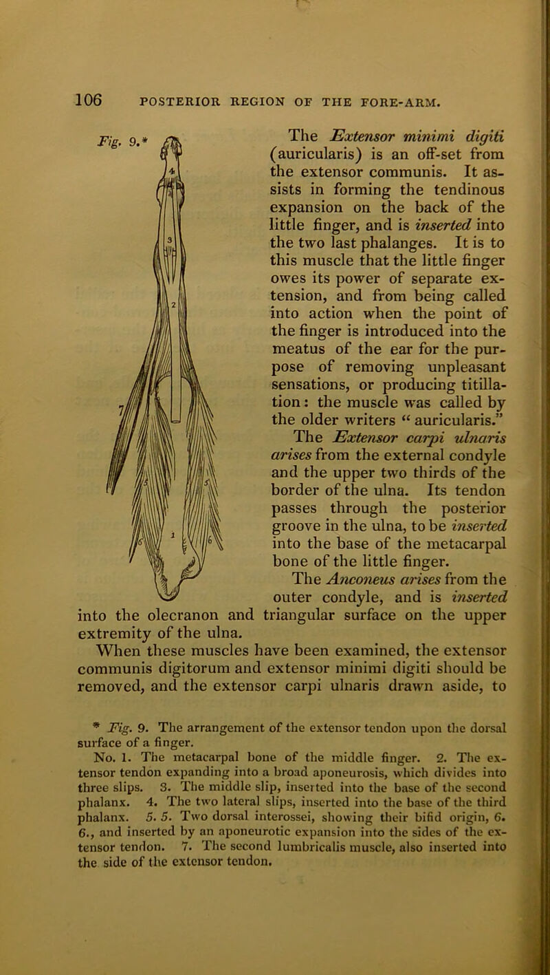 The Extensor minimi digiti (auricularis) is an off-set from the extensor communis. It as- sists in forming the tendinous expansion on the back of the little finger, and is inserted into the two last phalanges. It is to this muscle that the little finger owes its power of separate ex- tension, and from being called into action when the point of the finger is introduced into the meatus of the ear for the pur- pose of removing unpleasant sensations, or producing titilla- tion: the muscle was called by the older writers “ auricularis.” The Extensor carpi ulnaris arises from the external condyle and the upper two thirds of the border of the ulna. Its tendon passes through the posterior groove in the ulna, to be inserted into the base of the metacarpal bone of the little finger. The Anconeus arises from the outer condyle, and is inserted into the olecranon and triangular surface on the upper extremity of the ulna. When these muscles have been examined, the extensor communis digitorum and extensor minimi digiti should be removed, and the extensor carpi ulnaris drawn aside, to * Fig. 9. The arrangement of the extensor tendon upon the dorsal surface of a finger. No. 1. The metacarpal bone of the middle finger. 2. The ex- tensor tendon expanding into a broad aponeurosis, which divides into three slips. 3. The middle slip, inserted into the base of the second phalanx. 4. The two lateral slips, inserted into the base of the third phalanx. 5. 5. Two dorsal interossei, showing their bifid origin, 6. 6., and inserted by an aponeurotic expansion into the sides of the ex- tensor tendon. 7. The second lumbricalis muscle, also inserted into the side of the extensor tendon.