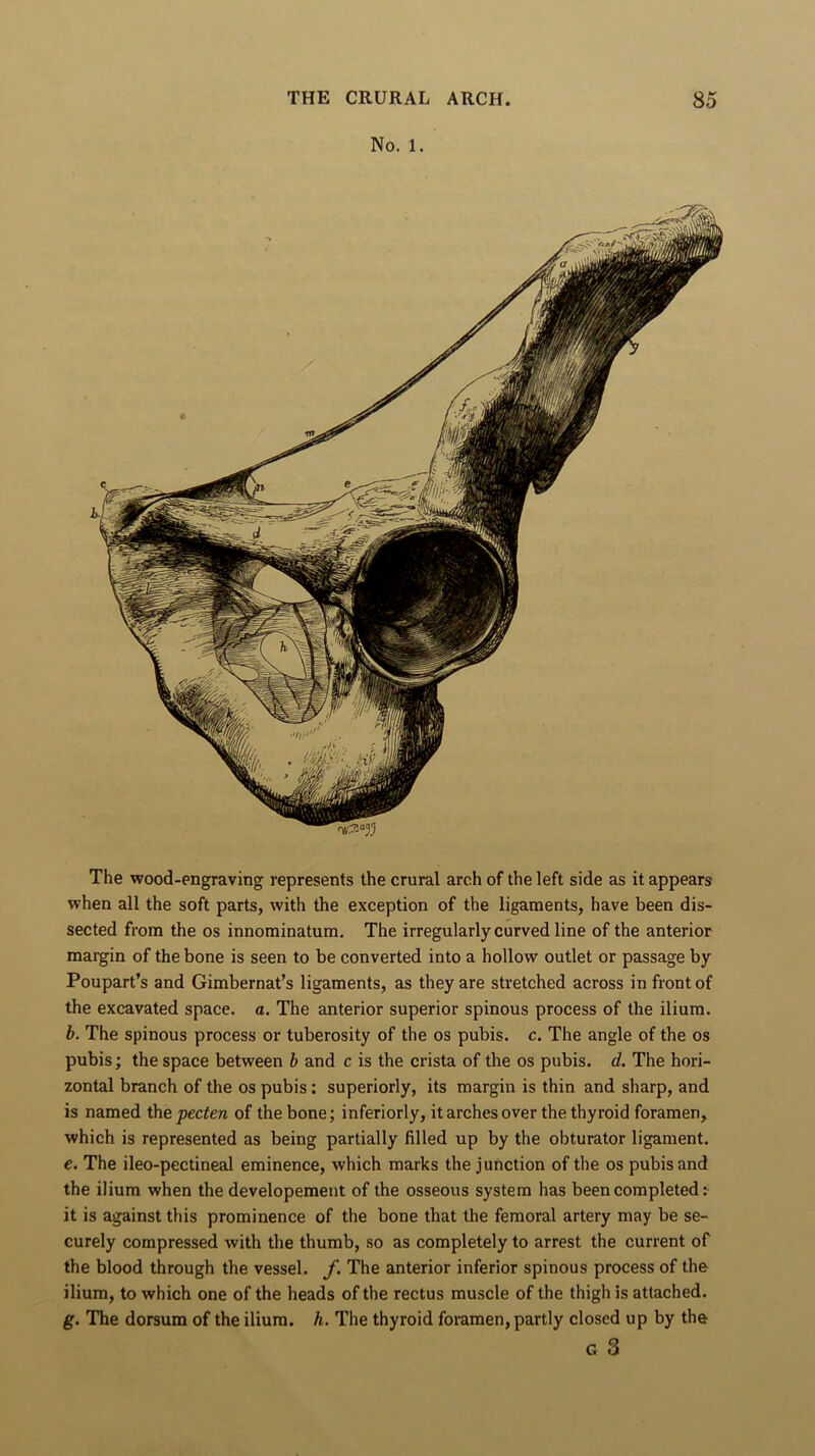 No. l. The wood-engraving represents the crural arch of the left side as it appears when all the soft parts, with the exception of the ligaments, have been dis- sected from the os innominatum. The irregularly curved line of the anterior margin of the bone is seen to be converted into a hollow outlet or passage by Poupart’s and Gimbernat’s ligaments, as they are stretched across in front of the excavated space, a. The anterior superior spinous process of the ilium. b. The spinous process or tuberosity of the os pubis, c. The angle of the os pubis; the space between b and c is the crista of the os pubis, d. The hori- zontal branch of the os pubis: superiorly, its margin is thin and sharp, and is named the pecten of the bone; inferiorly, it arches over the thyroid foramen, which is represented as being partially filled up by the obturator ligament. e. The ileo-pectineal eminence, which marks the junction of the os pubis and the ilium when the developement of the osseous system has been completed :■ it is against this prominence of the bone that the femoral artery may be se- curely compressed with the thumb, so as completely to arrest the current of the blood through the vessel, f. The anterior inferior spinous process of the ilium, to which one of the heads of the rectus muscle of the thigh is attached. g. The dorsum of the ilium, h. The thyroid foramen, partly closed up by the