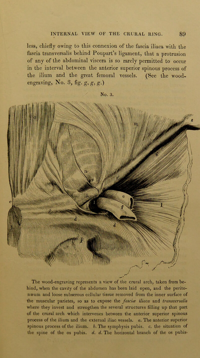 less, chiefly owing to this connexion of the fascia iliaca with the fascia transversalis behind Poupart’s ligament, that a protrusion of any of the abdominal viscera is so rarely permitted to occur in the interval between the anterior superior spinous process of the ilium and the great femoral vessels. (See the wood- engraving, No. S, fig. g, g, g.) No. 3. The wood-engraving represents a view of the crural arch, taken from be- hind, when the cavity of the abdomen has been laid open, and the perito- naeum and loose subserous cellular tissue removed from the inner surface of the muscular parietes, so as to expose the fascia iliaca and transversalis where they invest and strengthen the several structures filling up that part of the crural arch which intervenes between the anterior superior spinous process of the ilium and the external iliac vessels, a. The anterior superior spinous process of the ilium, b. The symphysis pubis, c. the situation of the spine of the os pubis, d. d. The horizontal branch of the os pubis-