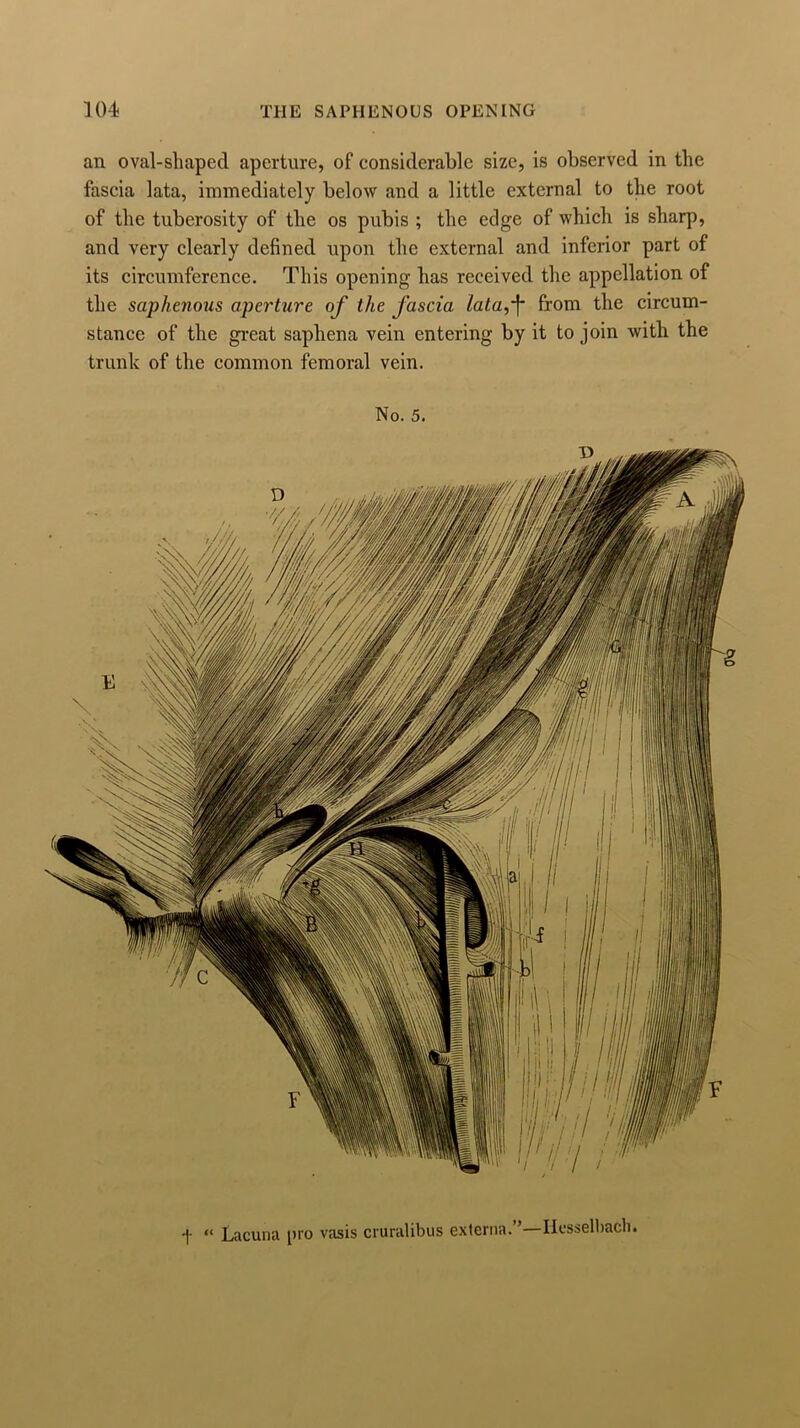 an oval-shaped aperture, of considerable size, is observed in the fascia lata, immediately below and a little external to the root of the tuberosity of the os pubis ; the edge of which is sharp, and very clearly defined upon the external and inferior part of its circumference. This opening has received the appellation of the saphenous aperture of the fascia lata,'f* from the circum- stance of the great saphena vein entering by it to join with the trunk of the common femoral vein. No. 5. “ Lacuna pro vasis cruralibus externa. ’—Itesselbach.