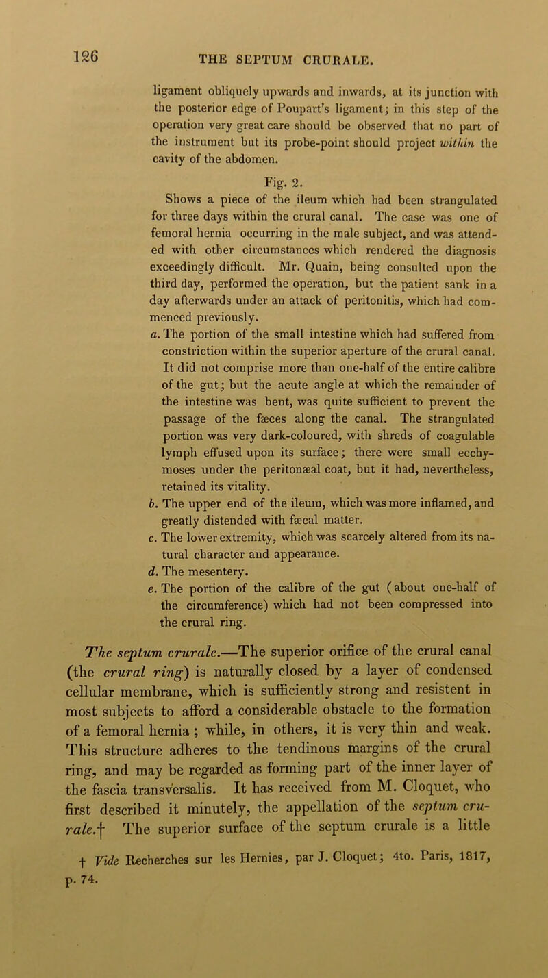 THE SEPTUM CRURALE. ligament obliquely upwards and inwards, at its junction with the posterior edge of Poupart’s ligament; in this step of the operation very great care should be observed that no part of the instrument but its probe-point should project within the cavity of the abdomen. Fig. 2. Shows a piece of the ileum which had been strangulated for three days within the crural canal. The case was one of femoral hernia occurring in the male subject, and was attend- ed with other circumstances which rendered the diagnosis exceedingly difficult. Mr. Quain, being consulted upon the third day, performed the operation, but the patient sank in a day afterwards under an attack of peritonitis, which had com- menced previously. a. The portion of the small intestine which had suffered from constriction within the superior aperture of the crural canal. It did not comprise more than one-half of the entire calibre of the gut; but the acute angle at which the remainder of the intestine was bent, was quite sufficient to prevent the passage of the faeces along the canal. The strangulated portion was very dark-coloured, with shreds of coagulable lymph effused upon its surface; there were small ecchy- moses under the peritonaeal coat, but it had, nevertheless, retained its vitality. b. The upper end of the ileum, which was more inflamed, and greatly distended with faecal matter. c. The lower extremity, which was scarcely altered from its na- tural character and appearance. d. The mesentery. e. The portion of the calibre of the gut (about one-half of the circumference) which had not been compressed into the crural ring. The septum crurale.—The superior orifice of the crural canal (the crural ring) is naturally closed by a layer of condensed cellular membrane, which is sufficiently strong and resistent in most subjects to afford a considerable obstacle to the formation of a femoral hernia ; while, in others, it is very thin and weak. This structure adheres to the tendinous margins of the crural ring, and may be regarded as forming part of the inner layer of the fascia transversalis. It has received from M. Cloquet, who first described it minutely, the appellation of the septum cru- rale.f The superior surface of the septum crurale is a little -J- Vide Recherches sur les Ilernies, par J. Cloquet; 4to. Paris, 1817, p. 74.