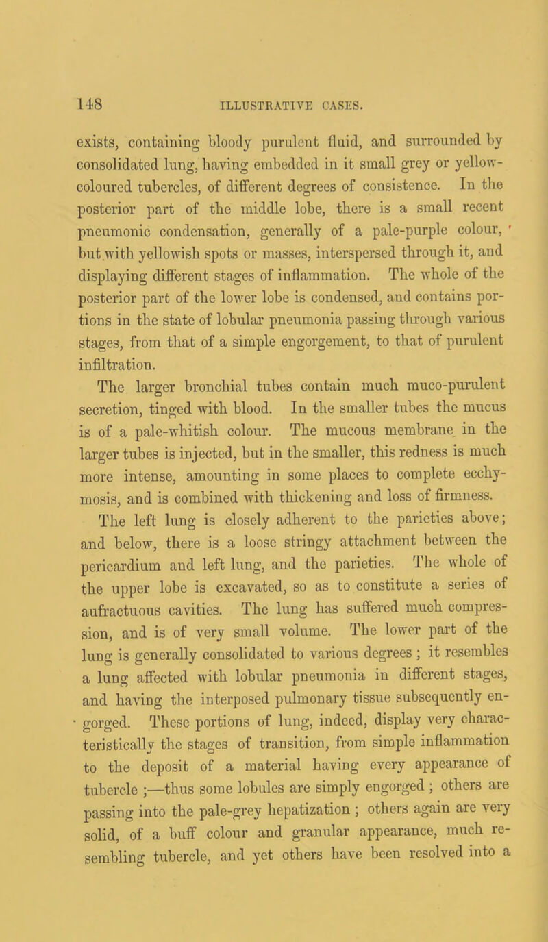 exists, containing bloody purulent fluid, and surrounded by consolidated lung, having embedded in it small grey or yellow- coloured tubercles, of different degrees of consistence. In the posterior part of the middle lobe, there is a small recent pneumonic condensation, generally of a pale-purple colour, * but with yellowish spots or masses, interspersed through it, and displaying different stages of inflammation. The whole of the posterior part of the lower lobe is condensed, and contains por- tions in the state of lobular pneumonia passing through various stages, from that of a simple engorgement, to that of purulent infiltratiou. The larger bronchial tubes contain much muco-purulent secretion, tinged with blood. In the smaller tubes the mucus is of a pale-whitish colour. The mucous membrane in the larger tubes is injected, but in the smaller, this redness is much more intense, amounting in some places to complete ecchy- mosis, and is combined with thickening and loss of firmness. The left lung is closely adherent to the parieties above; and below, there is a loose stringy attachment between the pericardium and left lung, and the parieties. The whole of the upper lobe is excavated, so as to constitute a series of aufractuous cavities. The lung has suffered much compres- sion, and is of very small volume. The lower part of the lung is generally consolidated to various degrees; it resembles a lung affected with lobular pneumonia in different stages, and having the interposed pulmonary tissue subsequently en- • gorged. These portions of lung, indeed, display very charac- teristically the stages of transition, from simple inflammation to the deposit of a material having every appearance of tubercle ;—thus some lobules are simply engorged ; others are passing into the pale-grey hepatization ; others again are very solid, of a buff colour and granular appearance, much re- sembling tubercle, and yet others have been resolved into a