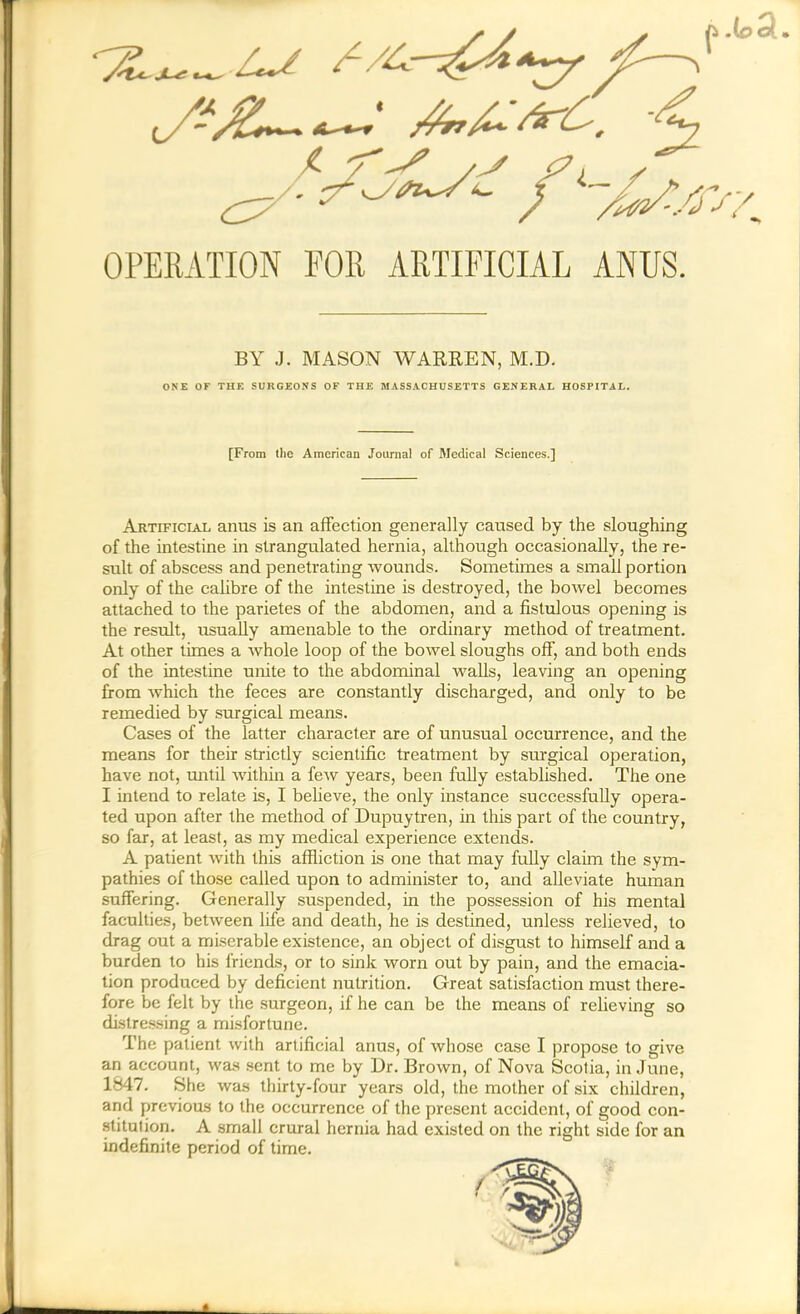 OPERATION FOR ARTIFICIAL ANUS. Artificial anus is an affection generally caused by the sloughing of the intestine in strangulated hernia, although occasionally, the re- sult of abscess and penetrating wounds. Sometimes a small portion only of the calibre of the intestine is destroyed, the bowel becomes attached to the parietes of the abdomen, and a fistulous opening is the result, usually amenable to the ordinary method of treatment. At other times a whole loop of the bowel sloughs off, and both ends of the intestine unite to the abdominal walls, leaving an opening from which the feces are constantly discharged, and only to be remedied by surgical means. Cases of the latter character are of unusual occurrence, and the means for their strictly scientific treatment by surgical operation, have not, until within a few years, been fully established. The one I intend to relate is, I believe, the only instance successfully opera- ted upon after the method of Dupuytren, in this part of the country, so far, at least, as my medical experience extends. A patient with this affliction is one that may fully claim the sym- pathies of those called upon to administer to, and alleviate human suffering. Generally suspended, in the possession of his mental faculties, between life and death, he is destined, unless relieved, to drag out a miserable existence, an object of disgust to himself and a burden to his friends, or to sink worn out by pain, and the emacia- tion produced by deficient nutrition. Great satisfaction must there- fore be felt by the surgeon, if he can be the means of relieving so distressing a misfortune. The patient with artificial anus, of whose case I propose to give an account, was sent to me by Dr. Brown, of Nova Scotia, in June, 1847. She was thirty-four years old, the mother of six children, and previous to the occurrence of the present accident, of good con- stitution. A small crural hernia had existed on the right side for an indefinite period of time. BY J. MASON WARREN, M.D. ONE OF THE SURGEONS OF THE MASSACHUSETTS GENERAL HOSPITAL. [From the American Journal of Medical Sciences.]