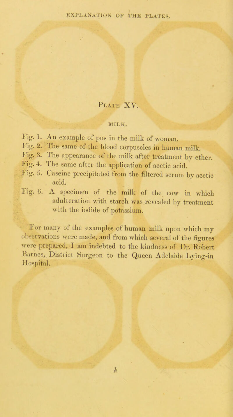 Plate XV. MILK. Pig. 1. An example of pus in the milk of woman. 1 ig. 2. The same of the blood corpuscles in human milk. I' ig. .3. The appearance of the milk after treatment by ether. 1* ig. 4. The same after the application of acetic acid. ]'ig. 5. Caseine precipitated from the filtered serum by acetic acid. Pig, 6. A specimen of the milk of the cow in which adulteration with starch was revealed by treatment with the iodide of potassium. k or many of the examples of human milk upon which my observations were made, and from which several of the figures were prepared, I am indebted to the kindness of Dr. Robert Harnes, District Surgeon to the Queen Adelaide Lying-in Hospital. k