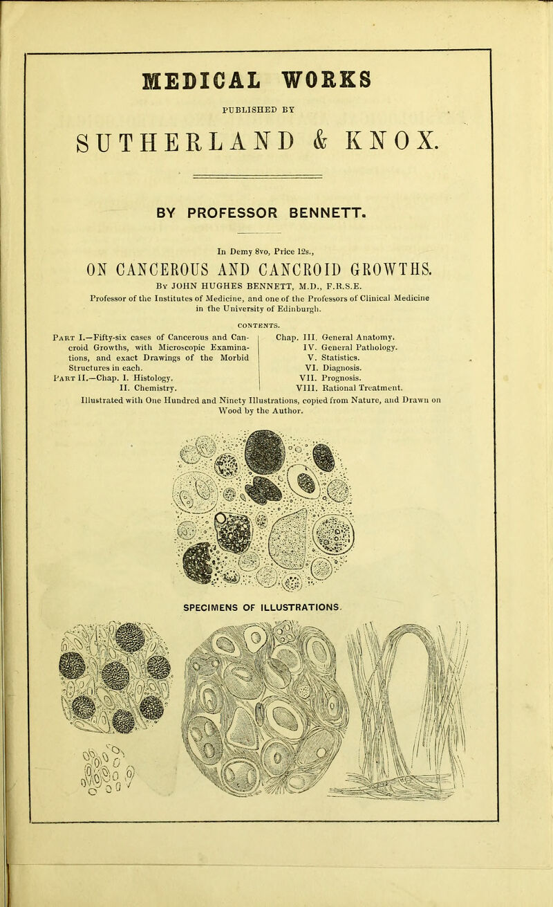 MEDICAL WORKS PUBLISHED BY SUTHERLAND & KNOX. BY PROFESSOR BENNETT. In Demy 8vo, Price 12s., ON CANCEROUS AND CANCROID GROWTHS. By JOHN HUGHES BENNETT, M.D., F.R.S.E. Professor of the Institutes of Medicine, and one of the Professors of Clinical Medicine in the University of Edinburgh. CONTENTS. Part I.—Fifty-six cases of Cancerous and Can- croid Growths, with Microscopic Examina- tions, and exact Drawings of the Morbid Structures in each. Part II.—Chap. I. Histology. II. Chemistry. Chap. III. General Anatomy. IV. General Pathology. V. Statistics. VI. Diagnosis. VII. Prognosis. VIII. Rational Treatment. Illustrated with One Hundred and Ninety Illustrations, copied from Nature, and Drawn on Wood by the Author. SPECIMENS OF ILLUSTRATIONS.