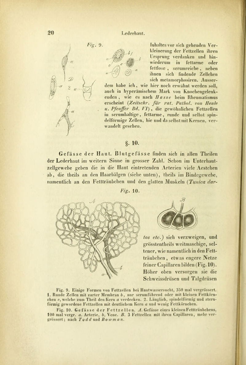 Inhaltes vor sich gehenden Ver- kleinerung der Fettzellcn ihren Ursprung verdanken und hin- wiederum in fettarme oder leltlose , serumreiche, neben ihnen sich findende Zellehen sich metamorphosiren. Ausser- dem habe ich, wie hier noeli erwähnt werden soll, auch in hyperümischem Mark von Knochengelenk- enden , wie cs nach Hasse heim Rheumatismus erscheint ('Zeitsehr. für rat. Pathol. von Hen/e u. Pfeuffer Bd. VI) , die gewöhnlichen Fettzellen in serumhaltige, fettarme, runde und selbst spin- delförmige Zellen, hie und da selbst mit Kernen, ver- wandelt gesehen. §. 10. Gefässc der Haut. Blutgefässe finden sich in allen Thcilen der Lederhaut im weitern Sinne in grosser Zahl. Schon im Uutcrhaut- zellgewebe geben die in die Haut eintretenden Arterien viele Aestchen ab, die theils an den Haarbälgcn (siehe unten), tlicils im Bindegewebe, namentlich an den Fettträubchen und den glatten Muskeln (Tunica dar- Fig. 10. tos etc.) sich verzweigen, und grösstentheils weitmaschige, sel- tener, wie namentlich in den Fett- träubchen , etwas engere Netze feiner Capillaren bilden (Fig. 10). Höher oben versorgen sie die Schwcissdrüsen und Talgdrüsen Fig. 9. Einige Formen von Fettzellen bei llautwassersucht, 350 mal vergrössert. 1. Runde Zellen mit zarter Membran b, nur serumfiilireml oder mit kleinen Fettkörn- chen c, welche zum Theil den Kern a verdecken. 2. Länglich, spindelförmig und stern- förmig gewordene Fettzellen mit deutlichem Kern n und wenig Fettköruchen. Fig. lü. Gefässc der Fettzellcn. A. Gefässe eines kleinen Fetttriiubchens, 100 mal vergr. a. Arterie, b. Vene. lt. 3 Fettzellen mit ihren Capillaren, mehr ver- grössert; nach To dd und Bowm a n.