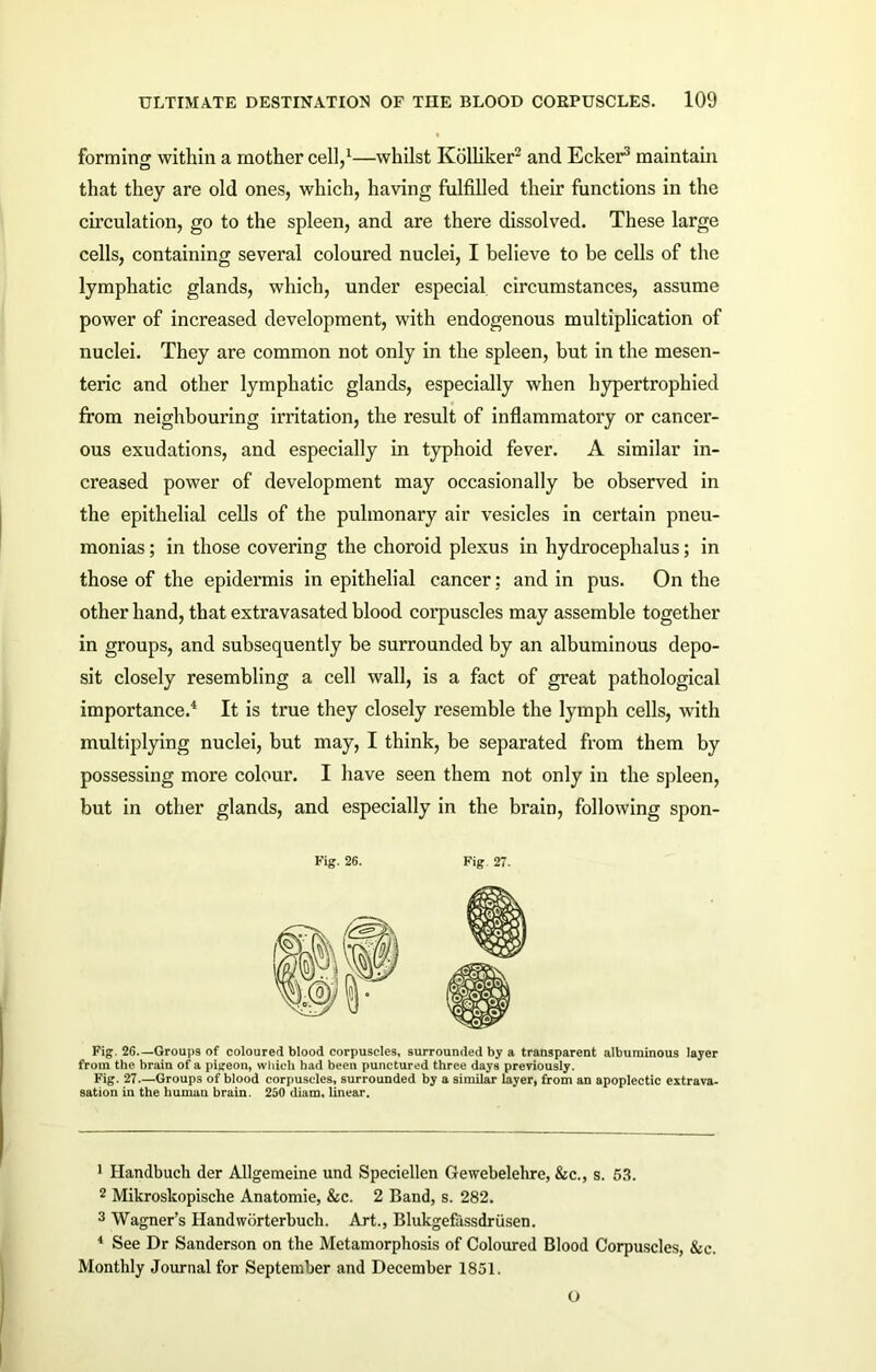 forming within a mother cell,1—whilst Kolliker2 and Ecker3 maintain that they are old ones, which, having fulfilled their functions in the circulation, go to the spleen, and are there dissolved. These large cells, containing several coloured nuclei, I believe to be cells of the lymphatic glands, which, under especial circumstances, assume power of increased development, with endogenous multiplication of nuclei. They are common not only in the spleen, but in the mesen- teric and other lymphatic glands, especially when hypertrophied from neighbouring irritation, the result of inflammatory or cancer- ous exudations, and especially in typhoid fever. A similar in- creased power of development may occasionally be observed in the epithelial cells of the pulmonary air vesicles in certain pneu- monias ; in those covering the choroid plexus in hydrocephalus; in those of the epidermis in epithelial cancer: and in pus. On the other hand, that extravasated blood corpuscles may assemble together in groups, and subsequently be surrounded by an albuminous depo- sit closely resembling a cell wall, is a fact of great pathological importance.4 It is true they closely resemble the lymph cells, with multiplying nuclei, but may, I think, be separated from them by possessing more colour. I have seen them not only in the spleen, but in other glands, and especially in the brain, following spon- Fig. 26. Fig 27. Fig. 26.—Groups of coloured blood corpuscles, surrounded by a transparent albuminous layer from the brain of a pigeon, which had been punctured three days previously. Fig. 27.—Groups of blood corpuscles, surrounded by a similar layer, from an apoplectic extrava- sation in the human brain. 250 diam. linear. 1 Handbuch der Allgemeine und Speciellen Gewebelelire, &c., s. 53. 2 Mikroskopische Anatomie, &c. 2 Band, s. 282. 3 Wagner’s Handworterbuch. Art., Blukgefassdriisen. 4 See Dr Sanderson on the Metamorphosis of Coloured Blood Corpuscles, 8cc. Monthly Journal for September and December 1851. O