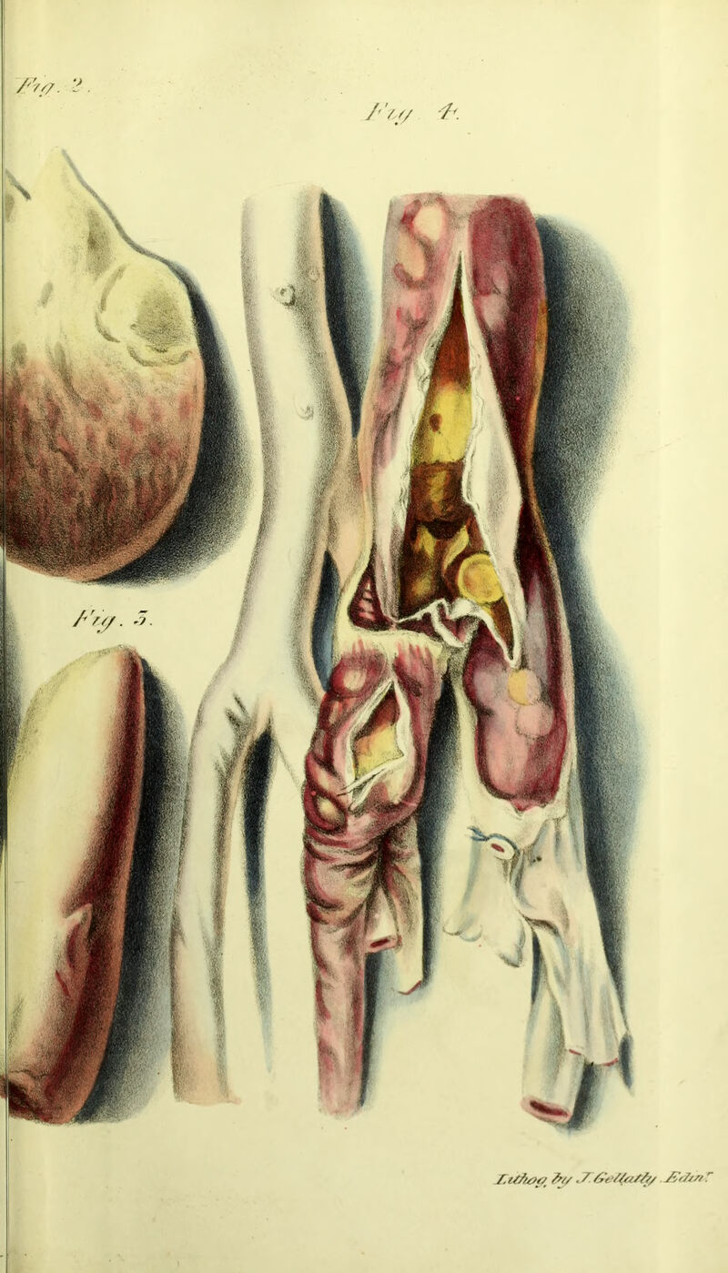 /'V/ Tw- fo/ //?/ .JZdisiT