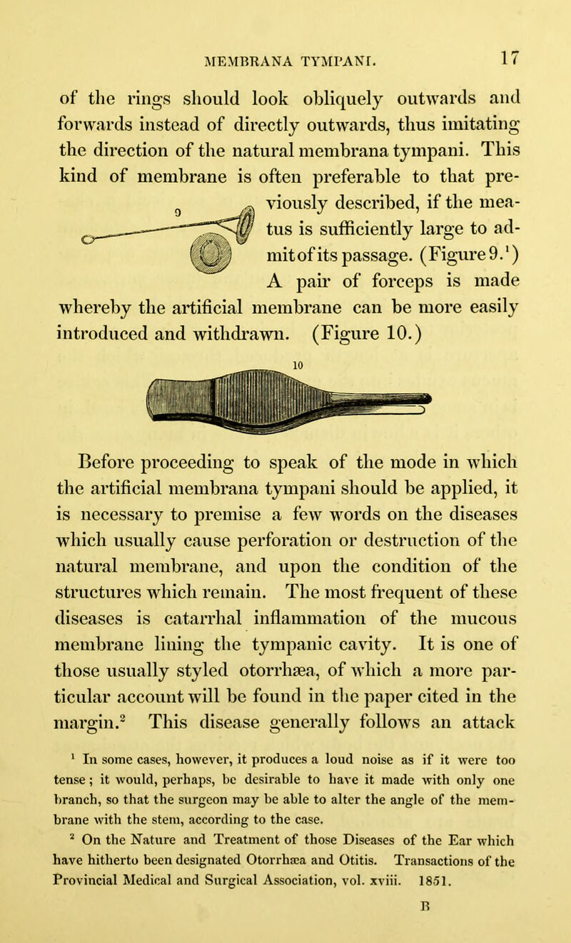 of the rings should look obliquely outwards and forwards instead of directly outwards, thus imitating the direction of the natural membrana tympani. This kind of membrane is often preferable to that pre- viously described, if the mea- tus is sufficiently large to ad- mit of its passage. (Figure9.*) A pair of forceps is made whereby the artificial membrane can be more easily introduced and withdrawn. (Figure 10.) 10 Before proceeding to speak of the mode in which the artificial membrana tympani should be applied, it is necessary to premise a few words on the diseases which usually cause perforation or destruction of the natural membrane, and upon the condition of the structures which remain. The most frequent of these diseases is catarrhal inflammation of the mucous membrane lining the tympanic cavity. It is one of those usually styled otorrhsea, of which a more par- ticular account will be found in the paper cited in the margin.® This disease generally follows an attack * In some cases, however, it produces a loud noise as if it were too tense; it would, perhaps, be desirable to have it made with only one branch, so that the surgeon may be able to alter the angle of the mem- brane with the stem, according to the case. ^ On the Nature and Treatment of those Diseases of the Ear which have hitherto been designated Otorrhaa and Otitis. Transactions of the Provincial Medical and Surgical Association, vol. xviii. 18-51. R
