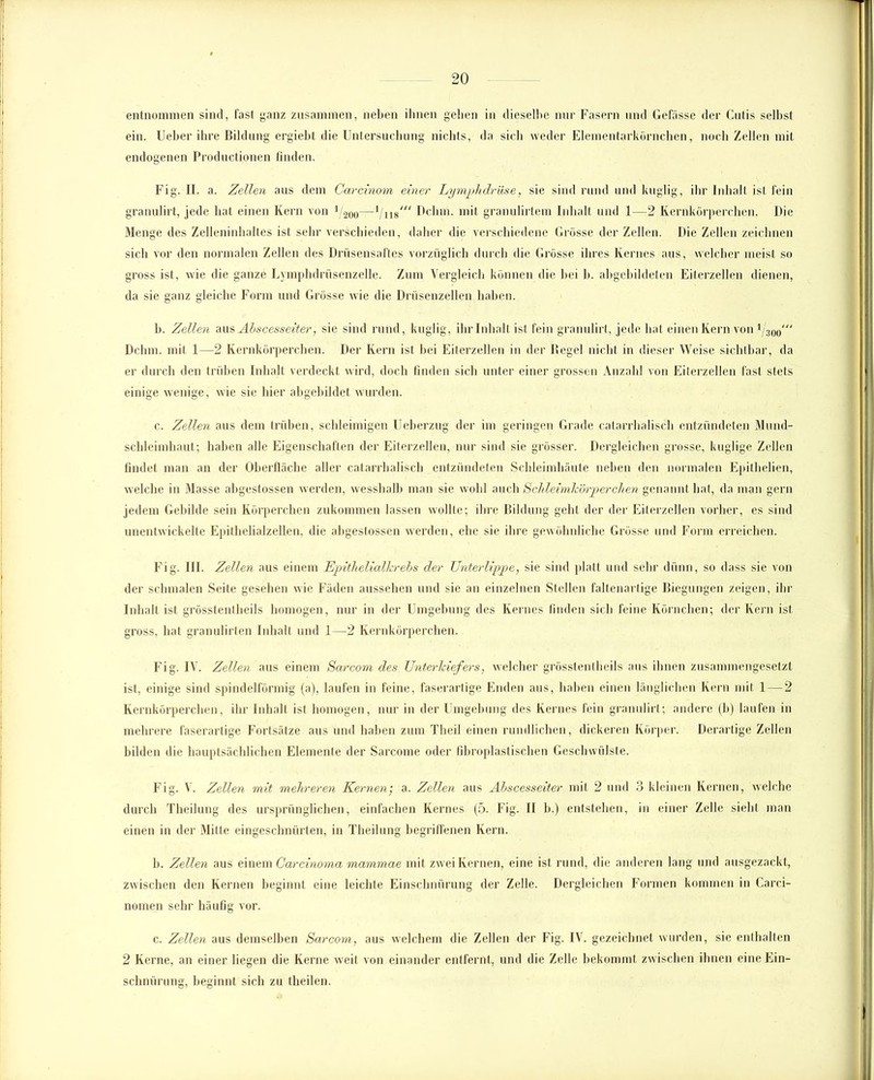 entnommen sind, fast ganz zusammen, neben ihnen gehen in dieselbe nur Fasern und Gefässe der Cutis selbst ein. Ueber ihre Bildung ergiebt die Untersuchung nichts, da sich weder Elementarkörnchen, noch Zellen mit endogenen Productionen finden. Fig. II. a. Zellen aus dem Carcinom einer Lymphdrüse, sie sind rund und kuglig, ihr Inhalt ist fein granulirt, jede hat einen Kern von l/200—lhn“ Dchm. mit granulirtem Inhalt und 1—2 Kernkörperchen. Die Menge des Zelleninhaltes ist sehr verschieden, daher die verschiedene Grösse der Zellen. Die Zellen zeichnen sich vor den normalen Zellen des Drüsensaftes vorzüglich durch die Grösse ihres Kernes aus, welcher meist so gross ist, wie die ganze Lymphdrüsenzelle. Zum Vergleich können die bei b. abgebildeten Eiterzellen dienen, da sie ganz gleiche Form und Grösse wie die Drüsenzellen haben. b. Zellen aus Äbscesseiter, sie sind rund, kuglig, ihr Inhalt ist fein granulirt, jede bat einen Kern von Dchm. mit 1—2 Kernkörperchen. Der Kern ist bei Eiterzellen in der Regel nicht in dieser Weise sichtbar, da er durch den trüben Inhalt verdeckt wird, doch finden sich unter einer grossen Anzahl von Eiterzellen fast stets einige wenige, wie sie hier abgebildet wurden. c. Zellen aus dem trüben, schleimigen Ueberzug der im geringen Grade catarrhalisch entzündeten Mund- schleimhaut-, haben alle Eigenschaften der Eiterzellen, nur sind sie grösser. Dergleichen grosse, kuglige Zellen findet man an der Oberfläche aller catarrhalisch entzündeten Schleimhäute neben den normalen Epitlielien, welche in Masse abgestossen werden, wesslialb man sie wohl auch Sehleimkörperchen genannt hat, da man gern jedem Gebilde sein Körperchen zukommen lassen wollte; ihre Bildung geht der der Eiterzellen vorher, es sind unentwickelte Epithelialzellen, die abgestossen werden, ehe sie ihre gewöhnliche Grösse und Form erreichen. Fig. III. Zellen aus einem Epithelialkrebs der Unterlippe, sie sind platt und sehr dünn, so dass sie von der schmalen Seite gesehen wie Fäden aussehen und sie an einzelnen Stellen faltenartige Biegungen zeigen, ihr Inhalt ist grösstentheils homogen, nur in der Umgebung des Kernes finden sich feine Körnchen; der Kern ist gross, bat granulirten Inhalt und 1—2 Kernkörperchen. Fig. IV. Zellen aus einem Sarcom des Unterkiefers, welcher grösstentheils aus ihnen zusammengesetzt ist, einige sind spindelförmig (a), laufen in feine, faserartige Enden aus, haben einen länglichen Kern mit 1 — 2 Kernkörperchen, ihr Inhalt ist homogen, nur in der Umgebung des Kernes fein granulirt; andere (b) laufen in mehrere faserartige Fortsätze aus und haben zum Theil einen rundlichen, dickeren Körper. Derartige Zellen bilden die hauptsächlichen Elemente der Sarcome oder fibroplastischen Geschwülste. Fig. V. Zellen mit mehreren Kernen', a. Zellen aus Äbscesseiter mit 2 und 3 kleinen Kernen, welche durch Theilung des ursprünglichen, einfachen Kernes (5. Fig. II b.) entstehen, in einer Zelle sieht man einen in der Mitte eingeschnürten, in Theilung begriffenen Kern. b. Zellen aus einem Carcinoma mammae mit zwei Kernen, eine ist rund, die anderen lang und ausgezackt, zwischen den Kernen beginnt eine leichte Einschnürung der Zelle. Dergleichen Formen kommen in Carci- nomen sehr häufig vor. c. Zellen aus demselben Sarcom, aus welchem die Zellen der Fig. IV. gezeichnet wurden, sie enthalten 2 Kerne, an einer liegen die Kerne weit von einander entfernt, und die Zelle bekommt zwischen ihnen eine Ein- schnürung, beginnt sich zu theilen.
