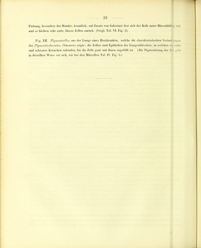 Färbung, besonders der Ränder, kenntlich, auf Zusatz von Salzsäure löst sieb der Kalk unter Blasenbildug auf, und es bleiben sehr zarte, blasse Zellen zurück. (Vergl. Taf. VI. Fig. 3). Fig. XII. Pigmentzellen aus der Lunge eines Herzkranken, welche die charakteristischen Verändmngen der Pigmentinduration (Virchow) zeigte; die Zellen sind Epithelien der Lungenbläschen, in welchen si rothe und schwarze Körnchen anhäufen, bis die Zelle ganz mit ihnen angefüllt ist. (Die Pigmentirung der Ze< gebt in derselben Weise vor sich, wie bei den Milzzellen Taf. IV. Fig. 6.)