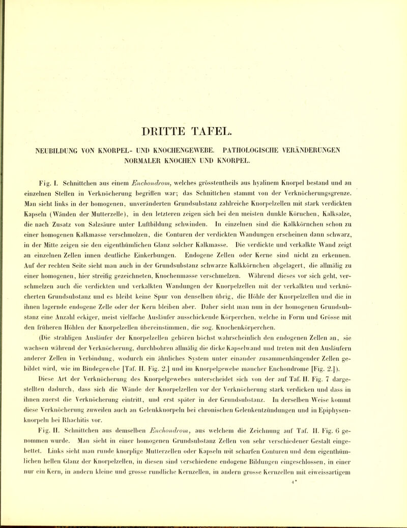 NEUBILDUNG VON KNORPEL- UND KNOCHENGEWEBE. PATHOLOGISCHE VERÄNDERUNGEN NORMALER KNOCHEN UND KNORPEL. Fig. I. Schnittchen ans einem EncTiondrom, welches grösstentheils aus hyalinem Knorpel bestand und an einzelnen Stellen in Verknöcherung begriffen war; das Schnittchen stammt von der Verknöcherungsgrenze. Man sieht links in der homogenen, unveränderten Grundsubstanz zahlreiche Knorpelzellen mit stark verdickten Kapseln (Wänden der Mutterzelle), in den letzteren zeigen sich bei den meisten dunkle Körnchen, Kalksalze, die nach Zusatz von Salzsäure unter Luftbildung schwinden. In einzelnen sind die Kalkkörnchen schon zu einer homogenen Kalkmasse verschmolzen, die Gonturen der verdickten Wandungen erscheinen dann schwarz, in der Mitte zeigen sie den eigentümlichen Glanz solcher Kalkmasse. Die verdickte und verkalkte Wand zeigt an einzelnen Zellen innen deutliche Einkerbungen. Endogene Zellen oder Kerne sind nicht zu erkennen. Auf der rechten Seite sieht man auch in der Grundsubstanz schwarze Kalkkörnchen abgelagert, die allmälig zu einer homogenen, hier streifig gezeichneten, Knochenmasse verschmelzen. Während dieses vor sich geht, ver- schmelzen auch die verdickten und verkalkten Wandungen der Knorpelzellen mit der verkalkten und verknö- cherten Grundsubstanz und es bleibt keine Spur von denselben übrig, die Höhle der Knorpelzellen und die in ihnen lagernde endogene Zelle oder der Kern bleiben aber. Daher sieht man nun in der homogenen Grundsub- stanz eine Anzahl eckiger, meist vielfache Ausläufer ausschickende Körperchen, welche in Form und Grösse mit den früheren Höhlen der Knorpelzellen übereinstimmen, die sog. Knochenkörperchen. (Die strahligen Ausläufer der Knorpelzellen gehören höchst wahrscheinlich den endogenen Zellen an, sie wachsen während der Verknöcherung, durchbohren allmälig die dicke Kapselwand und treten mit den Ausläufern anderer Zellen in Verbindung, wodurch ein ähnliches System unter einander zusammenhängender Zellen ge- bildet wird, wie im Bindegewebe [Taf. II. Fig. 2.] und im Knorpelgewebe mancher Enchondrome [Fig. 2.]). Diese Art der Verknöcherung des Knorpelgewebes unterscheidet sich von der auf Taf. II. Fig. 7 darge- stellten dadurch, dass sich die Wände der Knorpelzellen vor der Verknöcherung stark verdicken und dass in ihnen zuerst die Verknöcherung eintritt, und erst später in der Grundsubstanz. In derselben Weise kommt diese Verknöcherung zuweilen auch an Gelenkknorpeln bei chronischen Gelenkentzündungen und in Epiphysen- knorpeln bei Rbachitis vor. Fig. II. Schnittchen aus demselben Enchondrom, aus welchem die Zeichnung auf Taf. II. Fig. 6 ge- nommen wurde. Man sieht in einer homogenen Grundsubstanz Zellen von sehr verschiedener Gestalt einge- bettet. Links sieht man runde knorplige Mutterzellen oder Kapseln mit scharfen Gonturen und dem eigenthiim- lichen hellen Glanz der Knorpelzellen, in diesen sind verschiedene endogene Bildungen eingeschlossen, in einer nur ein Kern, in andern kleine und grosse rundliche Kernzellen, in andern grosse Kernzellen mit eiweissartigem