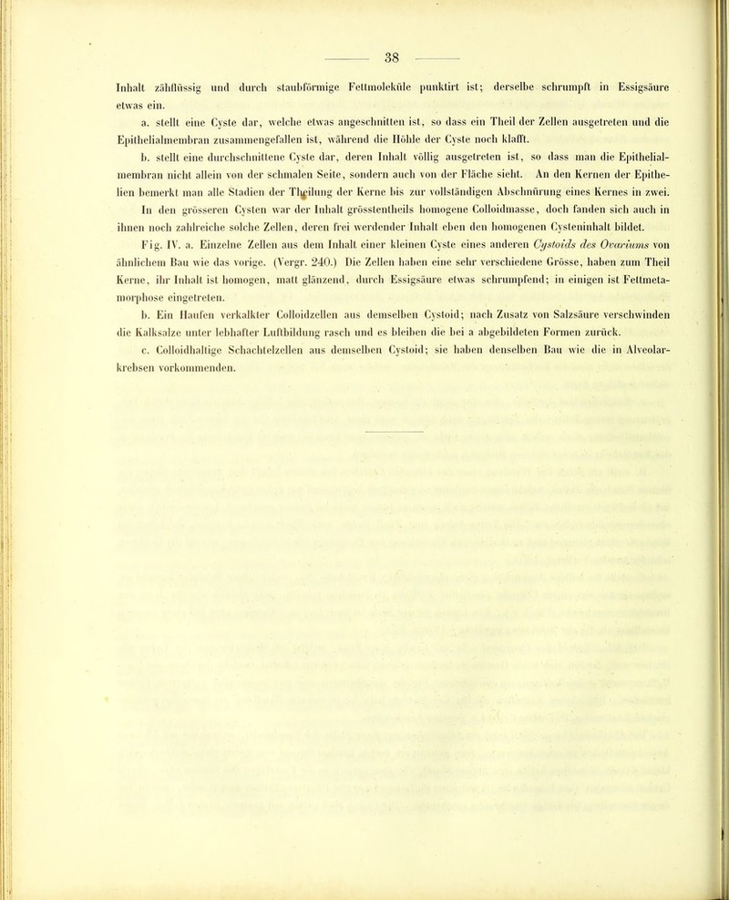 Inhalt zähflüssig und durch staubförmige Fettmoleküle punktirt ist; derselbe schrumpft in Essigsäure etwas ein. a. stellt eine Cyste dar, welche etwas angeschnitten ist, so dass ein Theil der Zellen ausgetreten und die Epithelialmembran zusammengefallen ist, während die Höhle der Cyste noch klafft. b. stellt eine durchschnittene Cyste dar, deren Inhalt völlig ausgetreten ist, so dass man die Epithelial- membran nicht allein von der schmalen Seite, sondern auch von der Fläche sieht. An den Kernen der Epithe- lien bemerkt man alle Stadien der Tlmilung der Kerne bis zur vollständigen Abschnürung eines Kernes in zwei. In den grösseren Cysten war der Inhalt grösstentheils homogene Colloidmasse, doch fanden sich auch in ihnen noch zahlreiche solche Zellen, deren frei werdender Inhalt eben den homogenen Cysteninhalt bildet. Fig. IV. a. Einzelne Zellen aus dem Inhalt einer kleinen Cyste eines anderen Cystoids des Ovariums von ähnlichem Bau wie das vorige. (Vergr. 240.) Die Zellen haben eine sehr verschiedene Grösse, haben zum Theil Kerne, ihr Inhalt ist homogen, matt glänzend, durch Essigsäure etwas schrumpfend; in einigen ist Fettmeta- morphose eingetreten. b. Ein Haufen verkalkter Colloidzellen aus demselben Cystoid; nach Zusatz von Salzsäure verschwinden die Kalksalze unter lebhafter Luftbildung rasch und es bleiben die bei a abgebildeten Formen zurück. c. Colloidhaltige Schachtelzellen aus demselben Cystoid; sie haben denselben Bau wie die in Alveolar- krebsen vorkommenden.